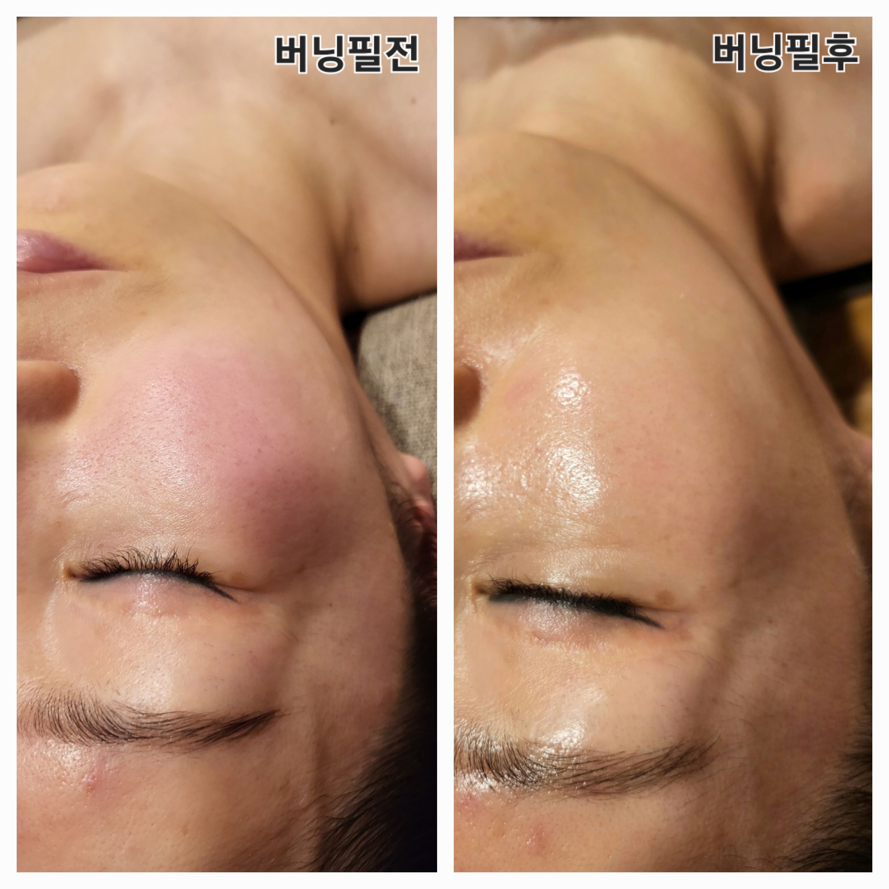 미라인스킨앤바디