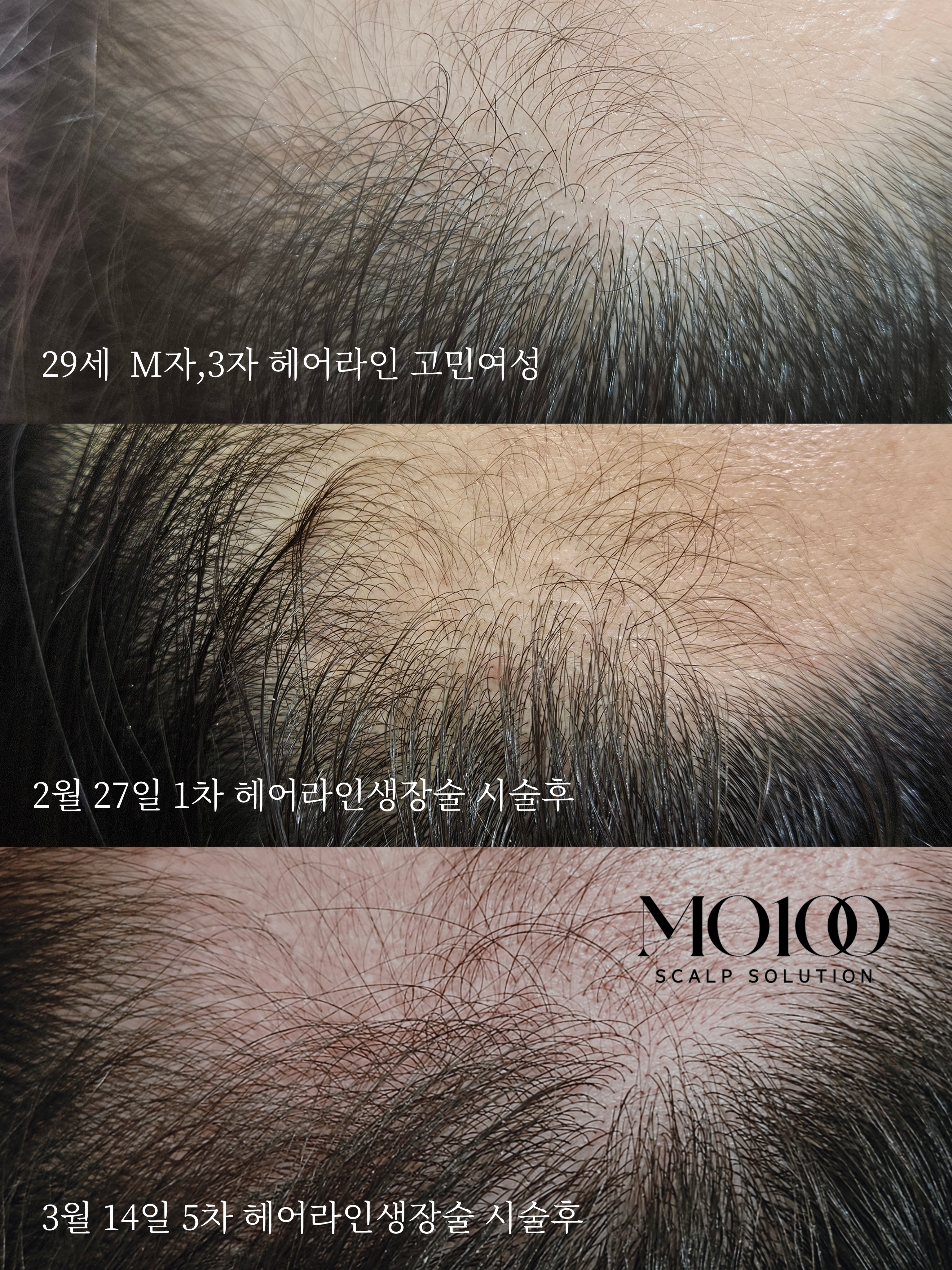 그레이스풀 대표 이미지