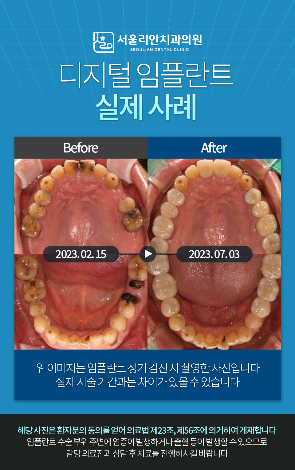 서울리안치과의원 대표 이미지