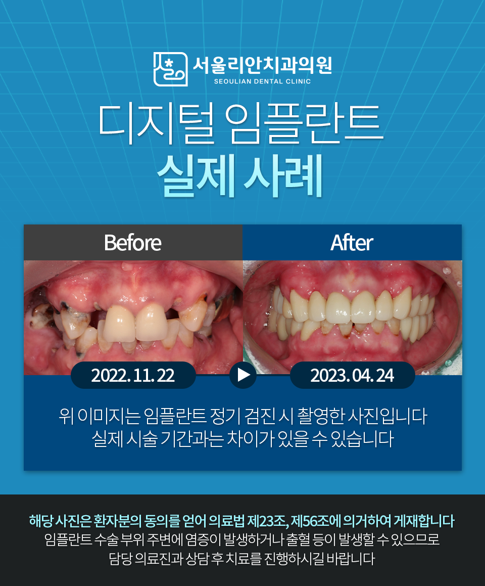 서울리안치과의원 대표 이미지