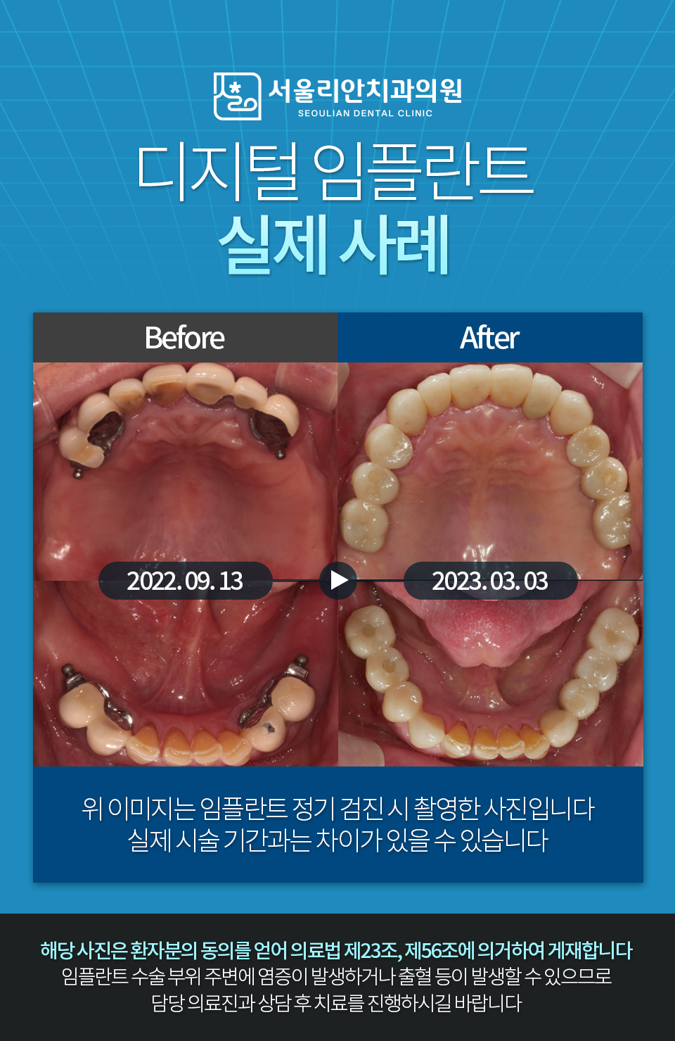 서울리안치과의원 대표 이미지