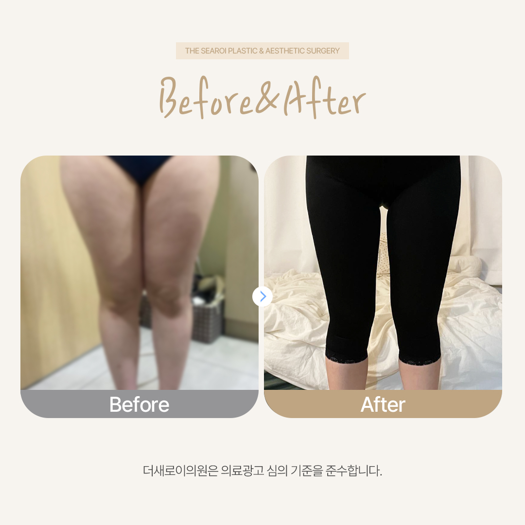 더새로이의원