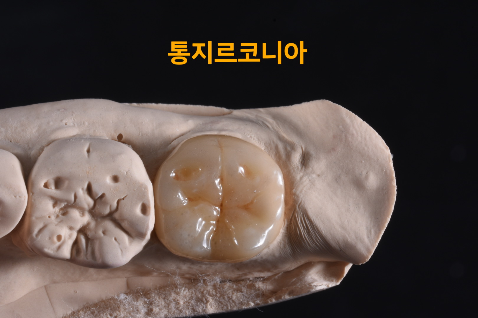 하트덴탈랩 대표 이미지