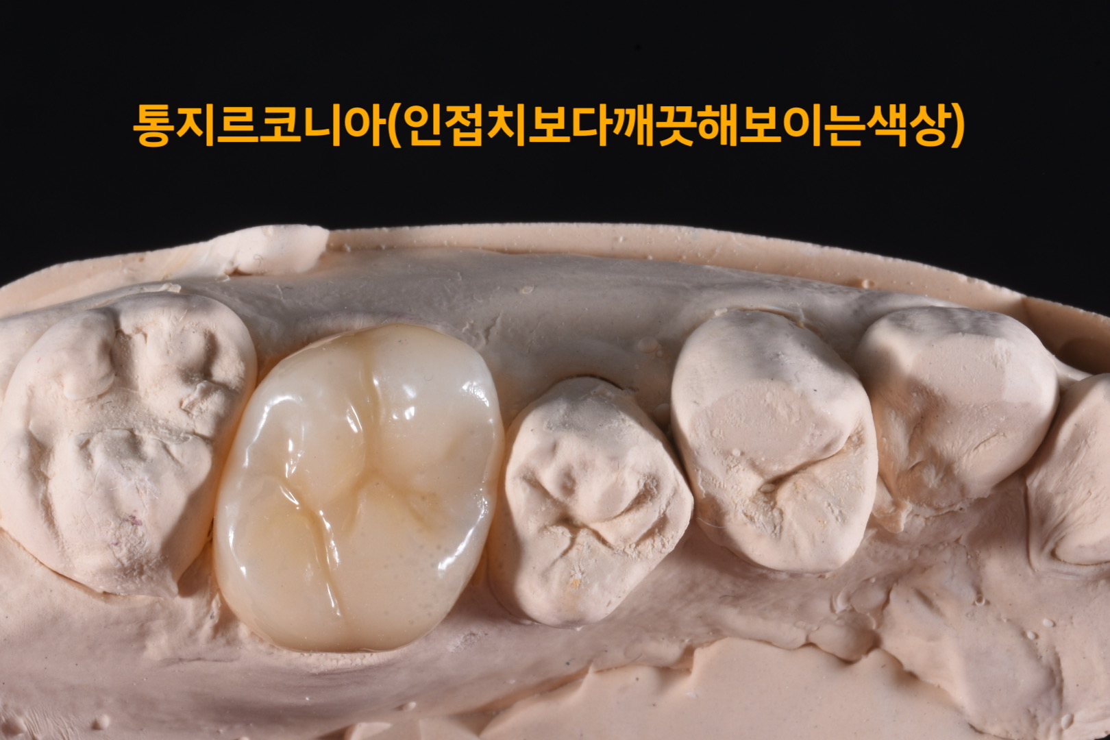 하트덴탈랩 대표 이미지