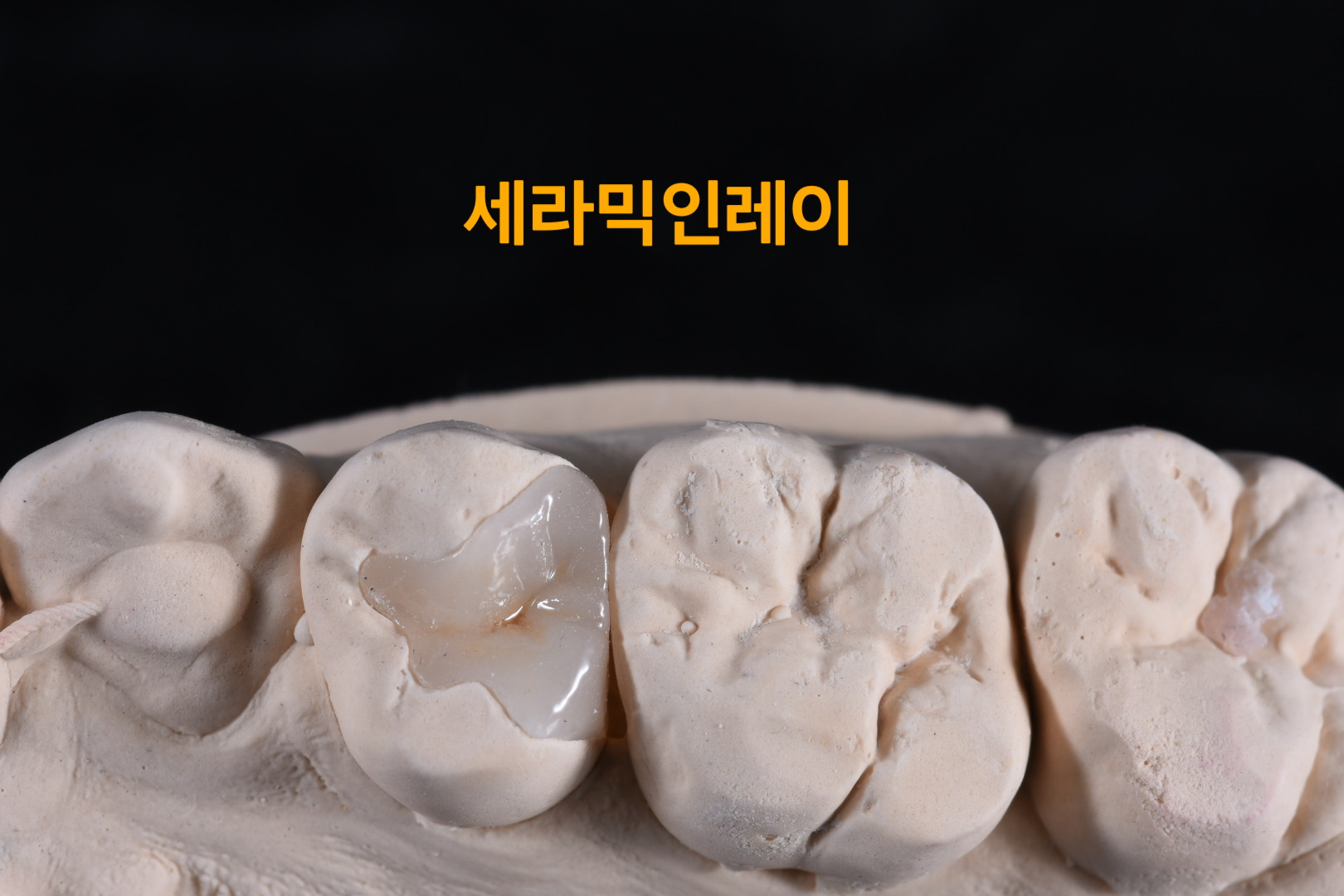 하트덴탈랩 대표 이미지