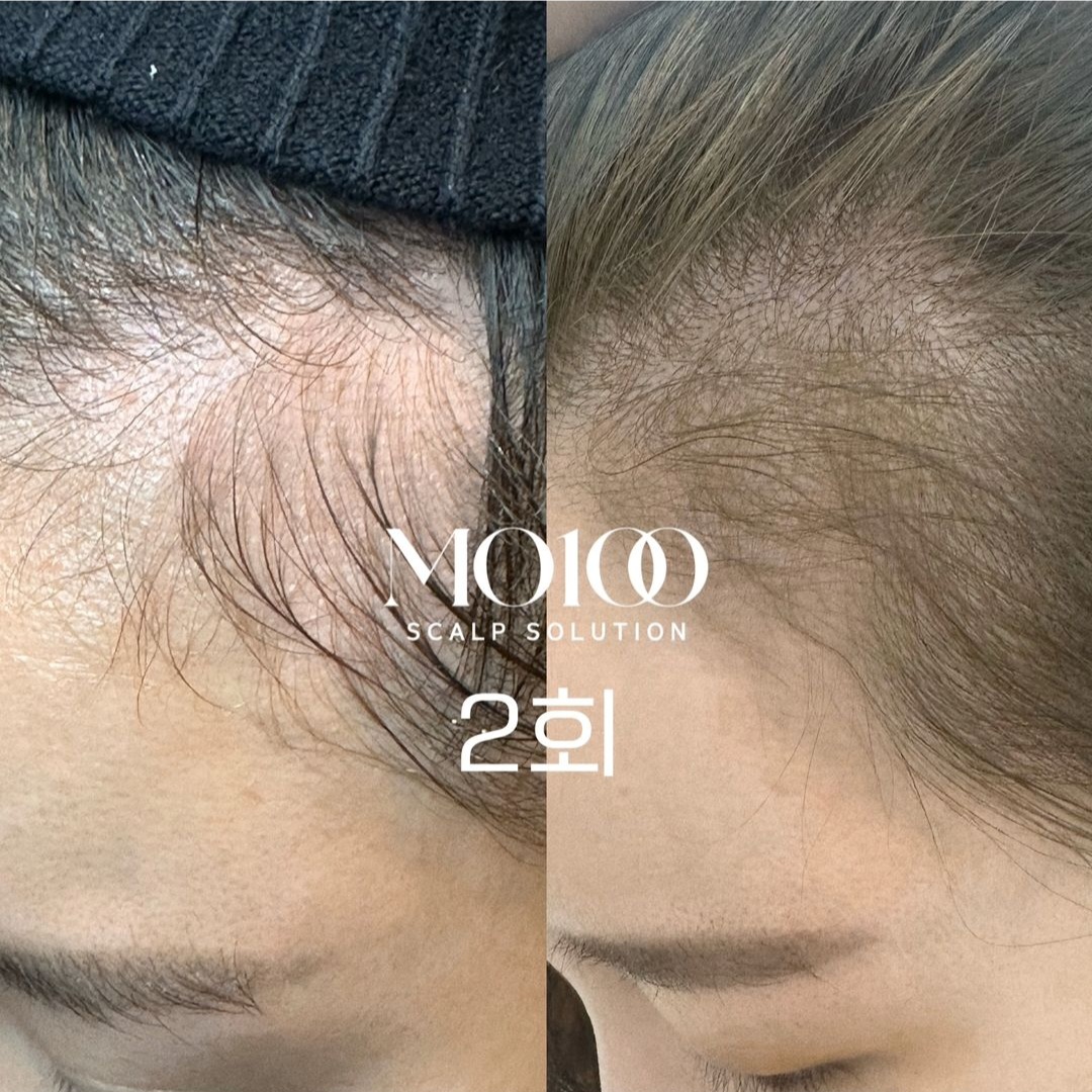 리데이헤드스파 이미지