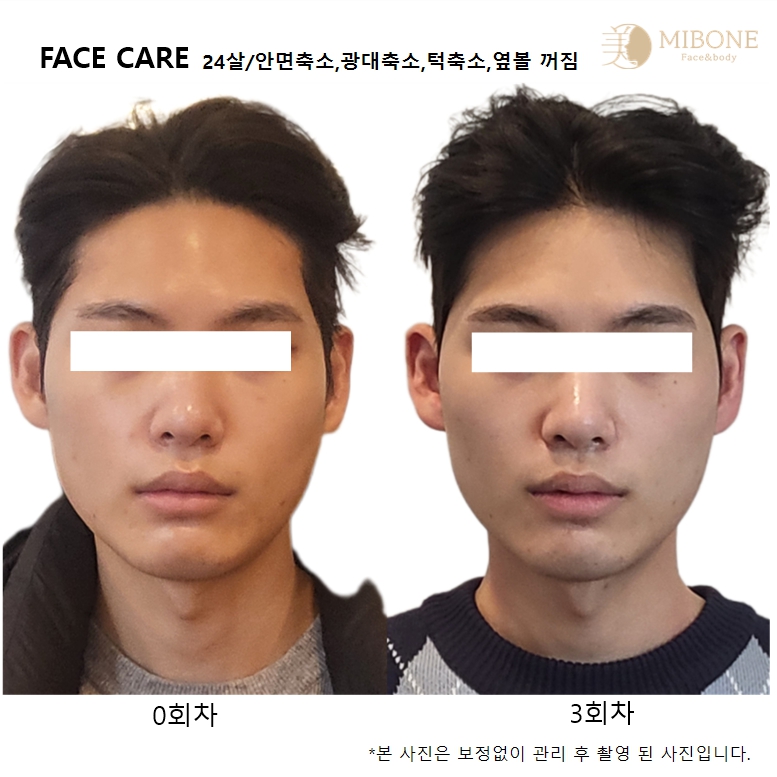 수뷰티&귀족다이어트