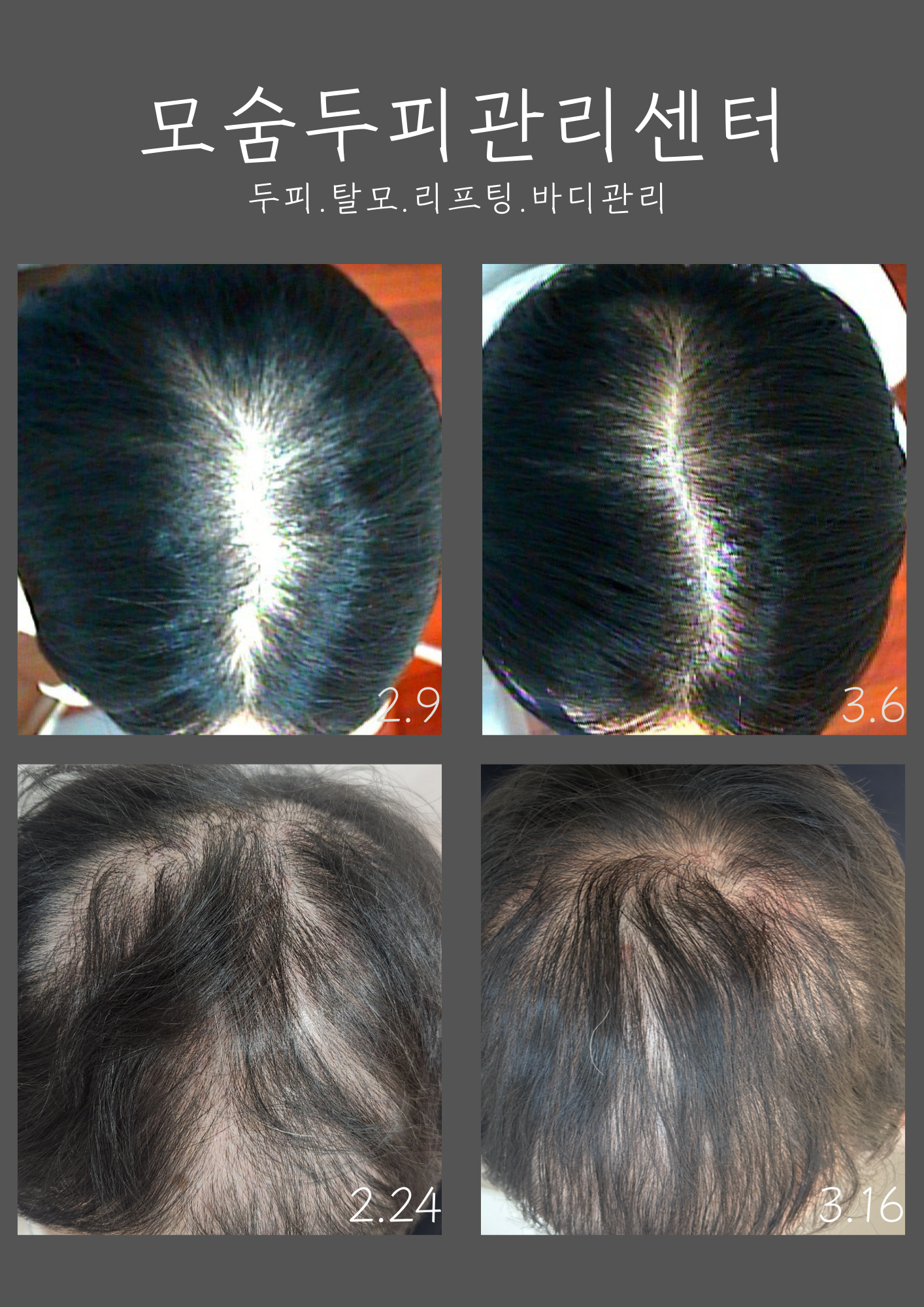 모숨피부두피센터 대표 이미지