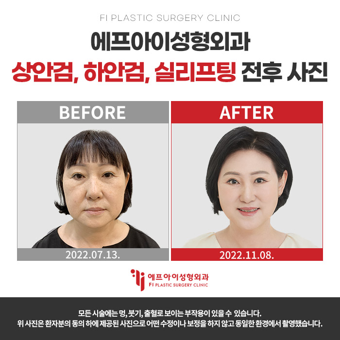 에프아이성형외과의원 대표 이미지