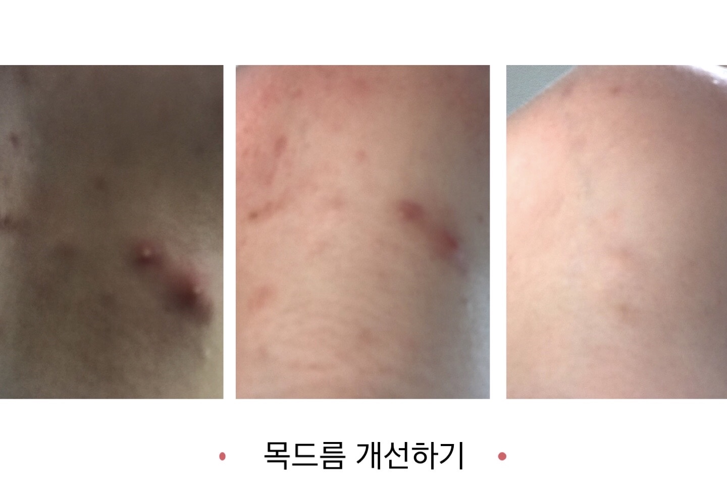 스킨소울