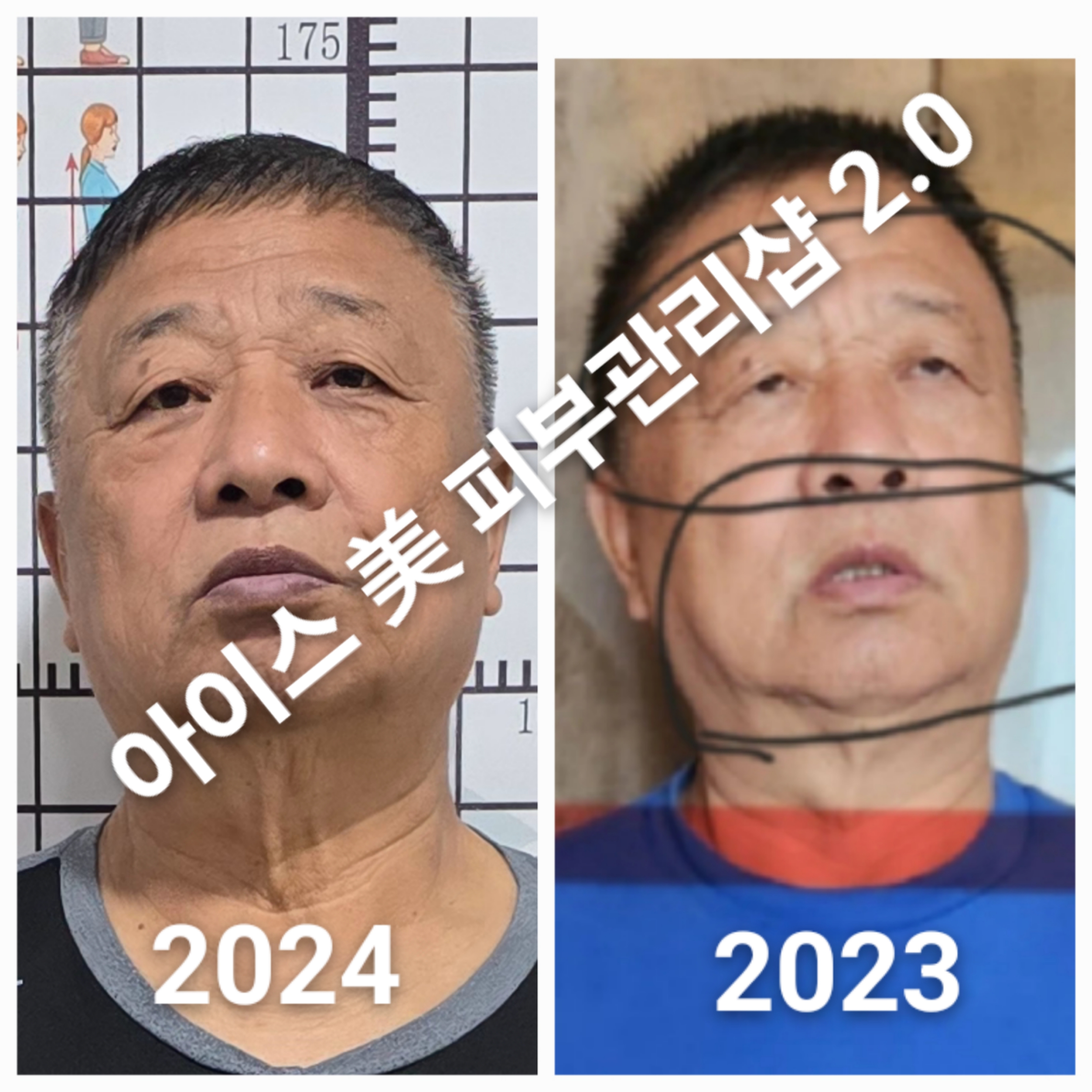 아이스미피부관리샵