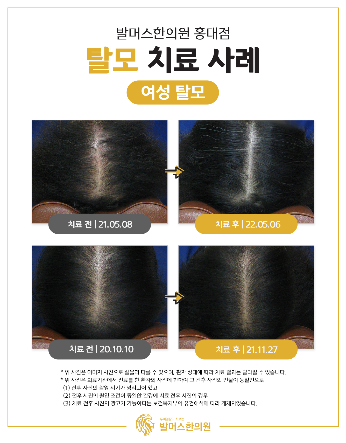 발머스한의원 홍대 대표 이미지