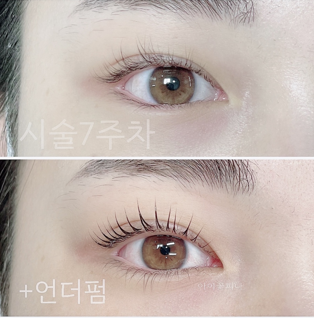 아이꽃피나