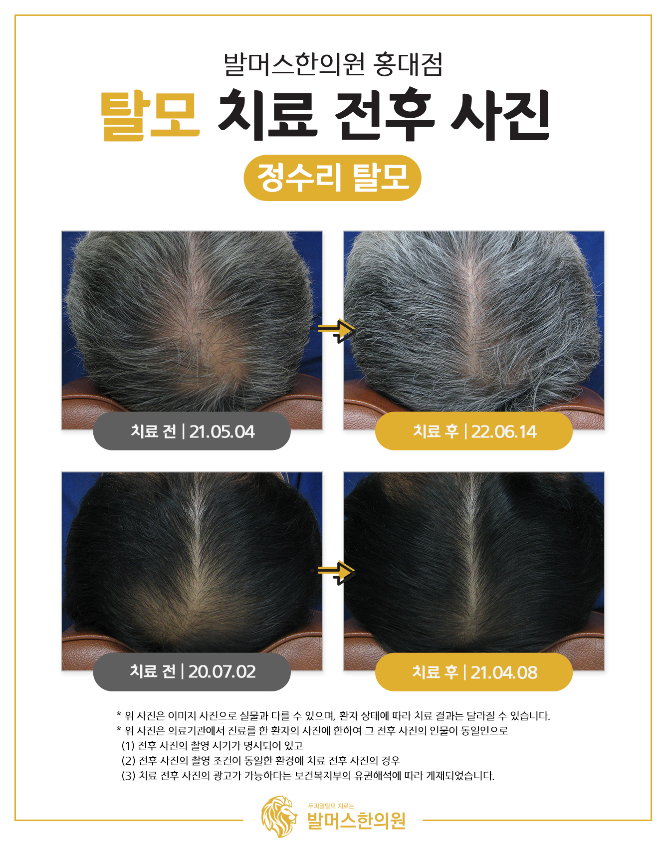 발머스한의원 홍대점 대표 이미지