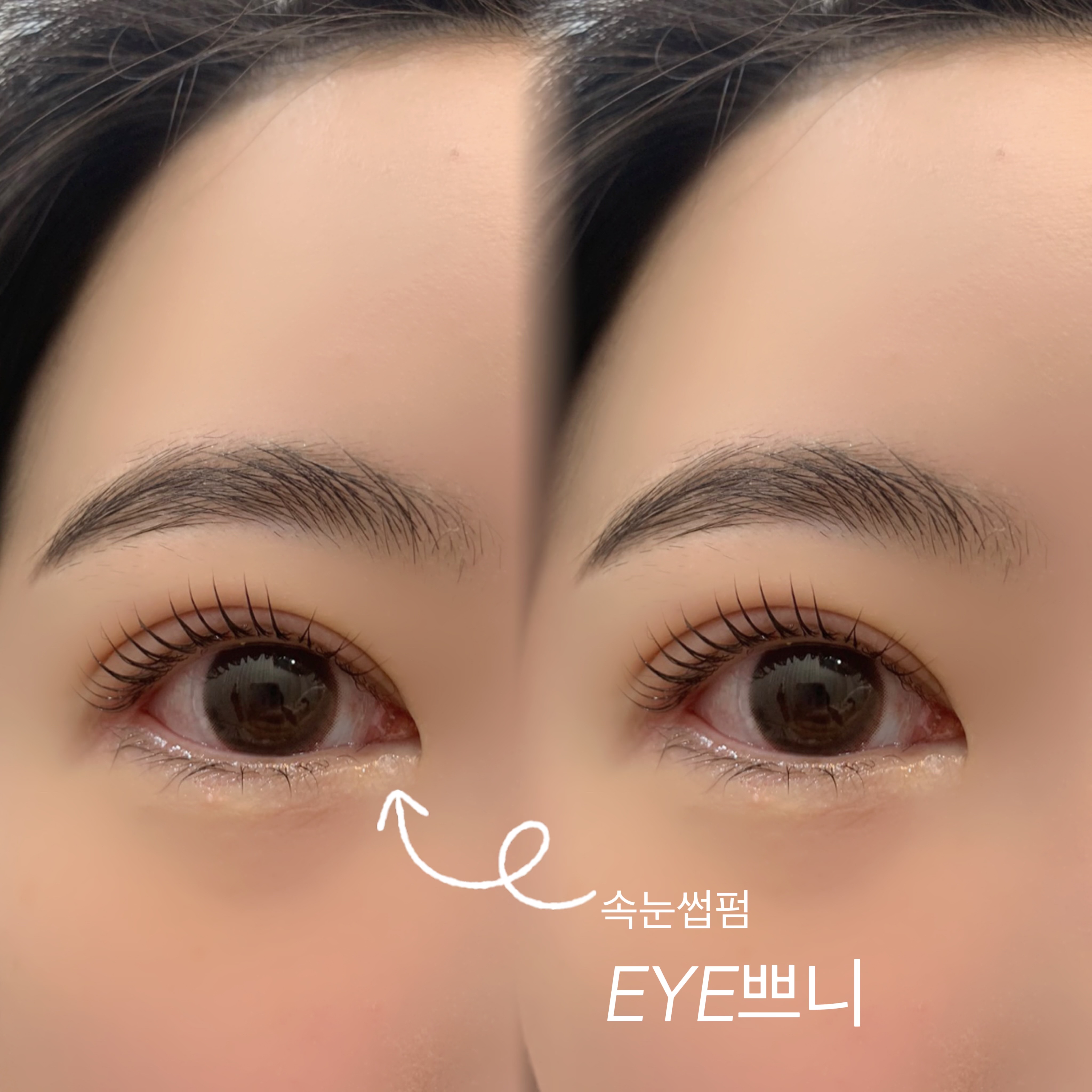 아이쁘니 대표 이미지