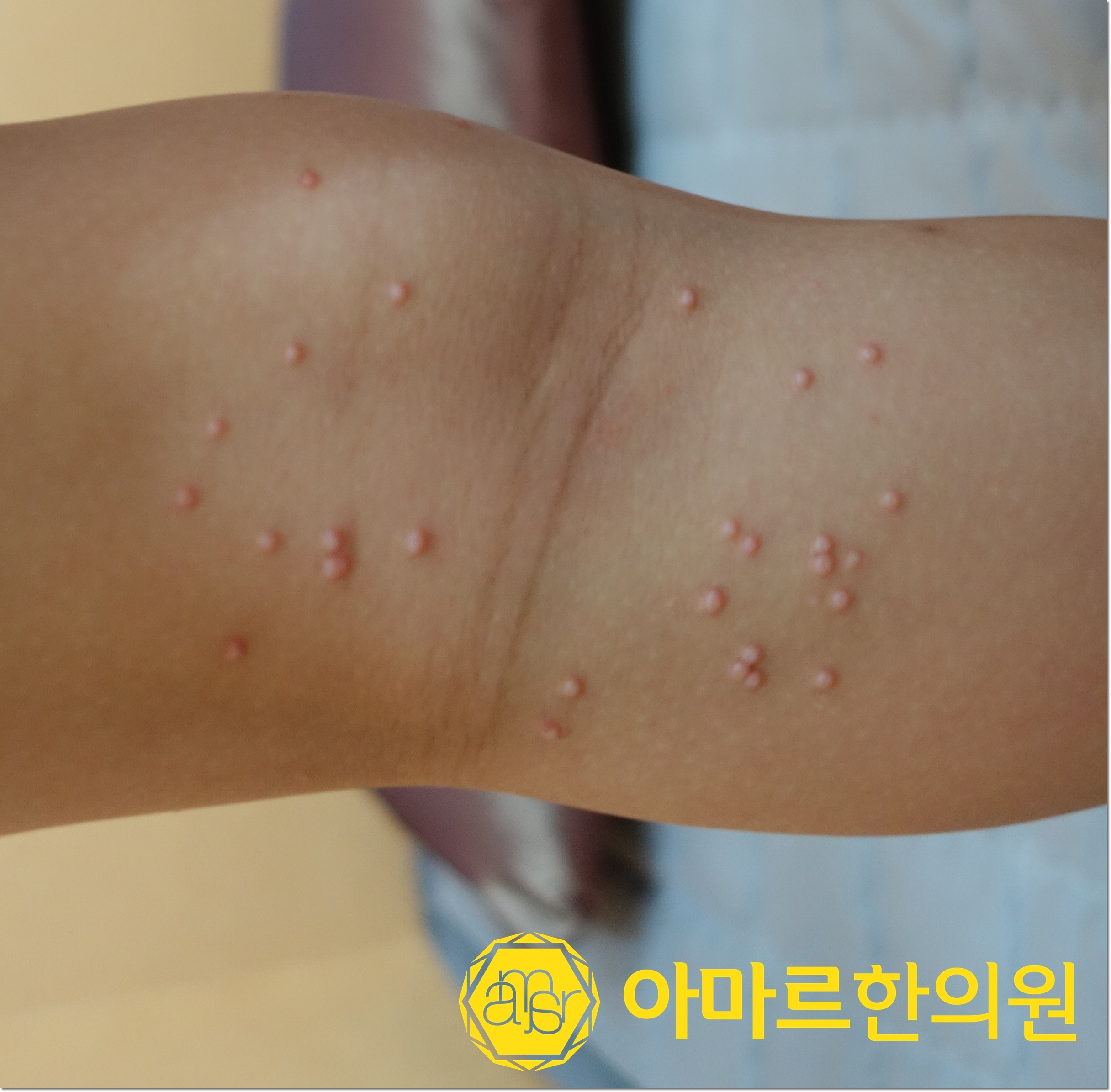 아마르한의원 하단점