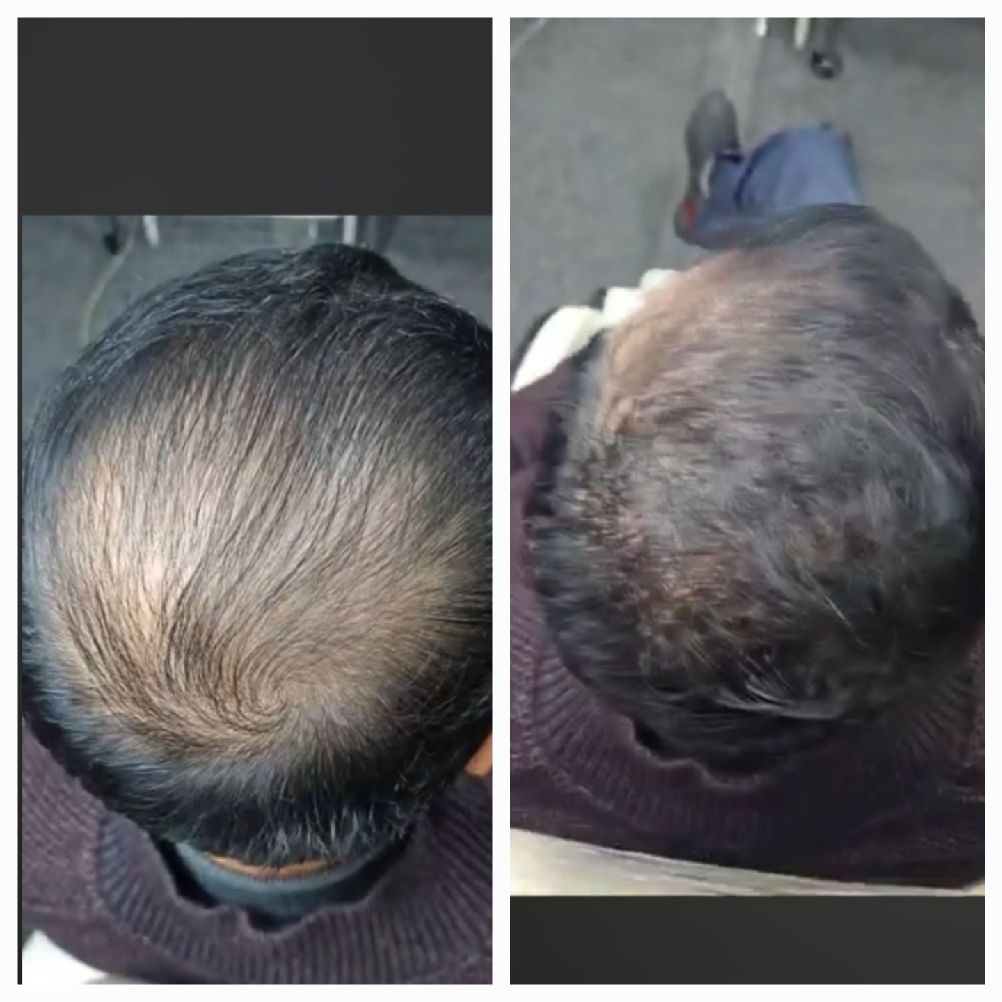 모가비 180도 염색두피모발관리 상왕십리점 대표 이미지