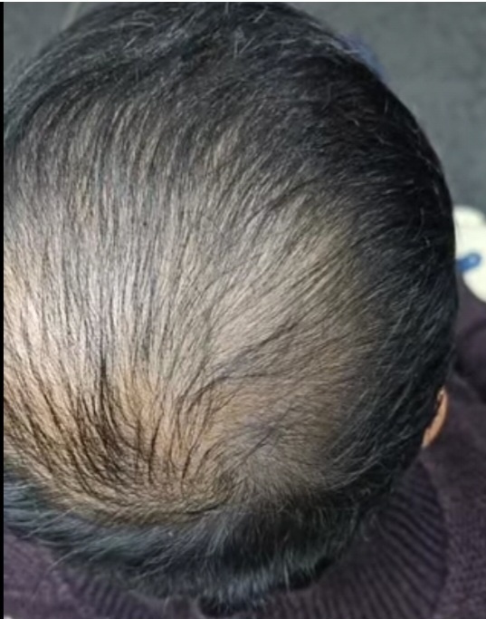 모가비 180도 대표 이미지