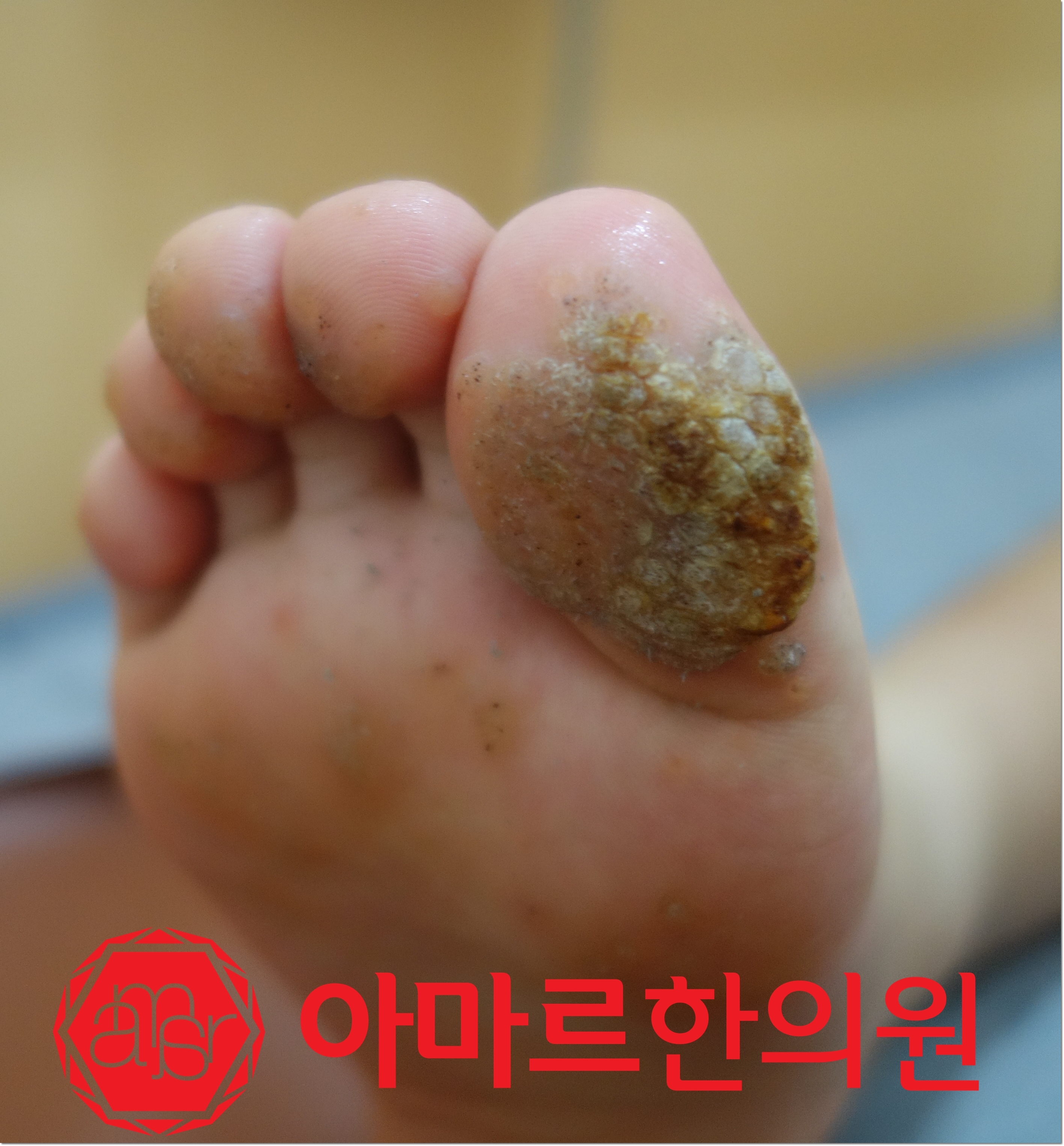 아마르한의원 하단점