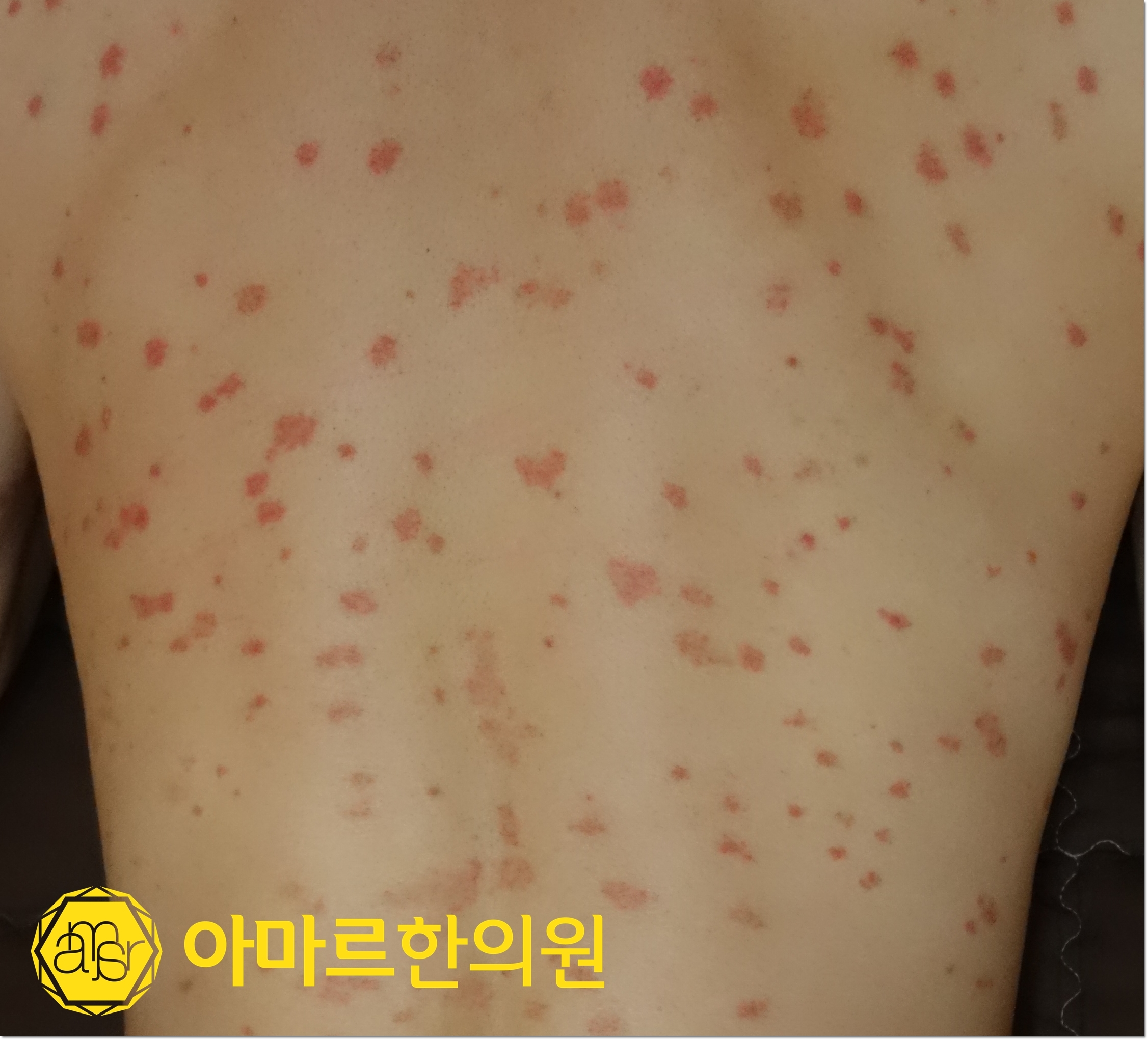 아마르한의원 하단점