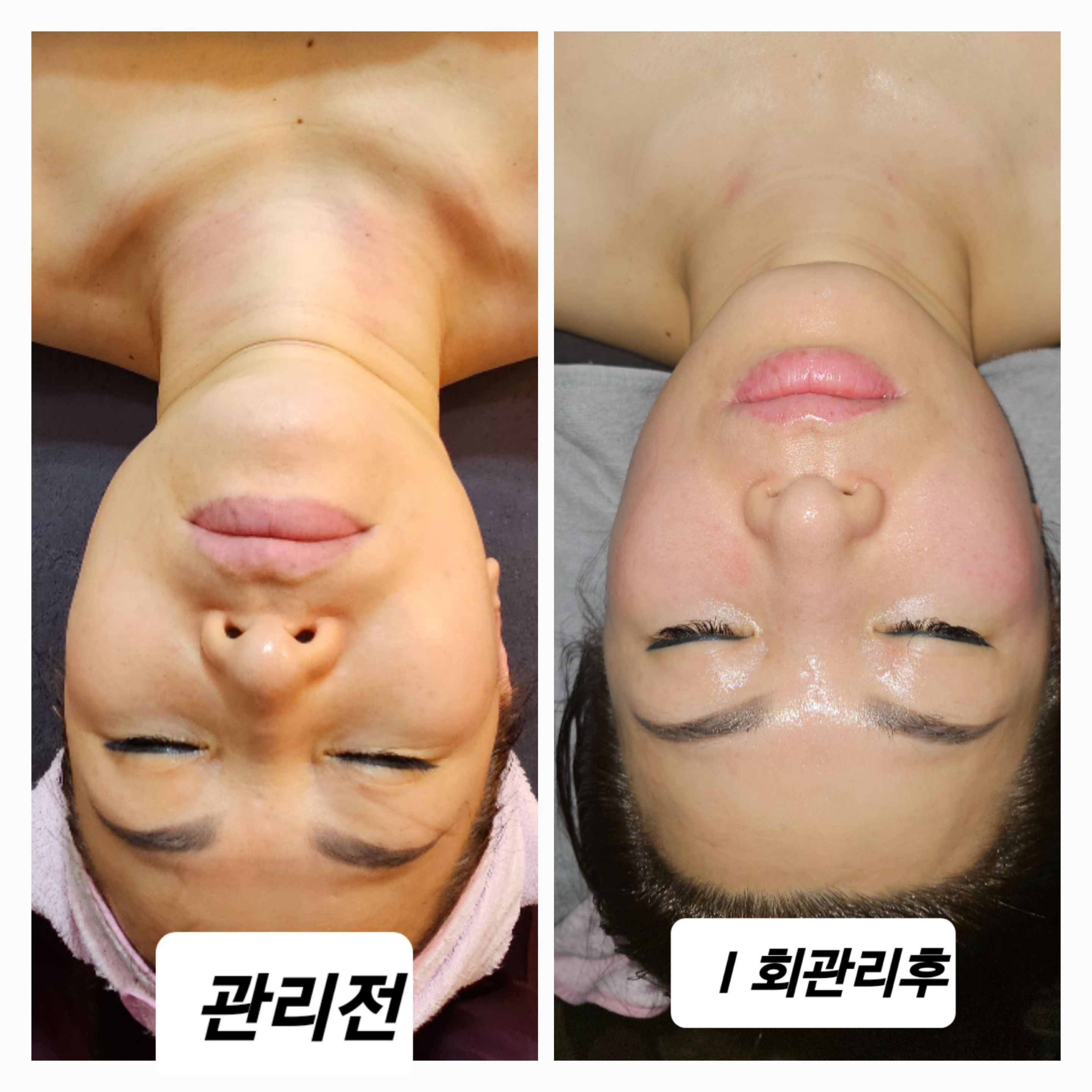 One피부관리 대표 이미지