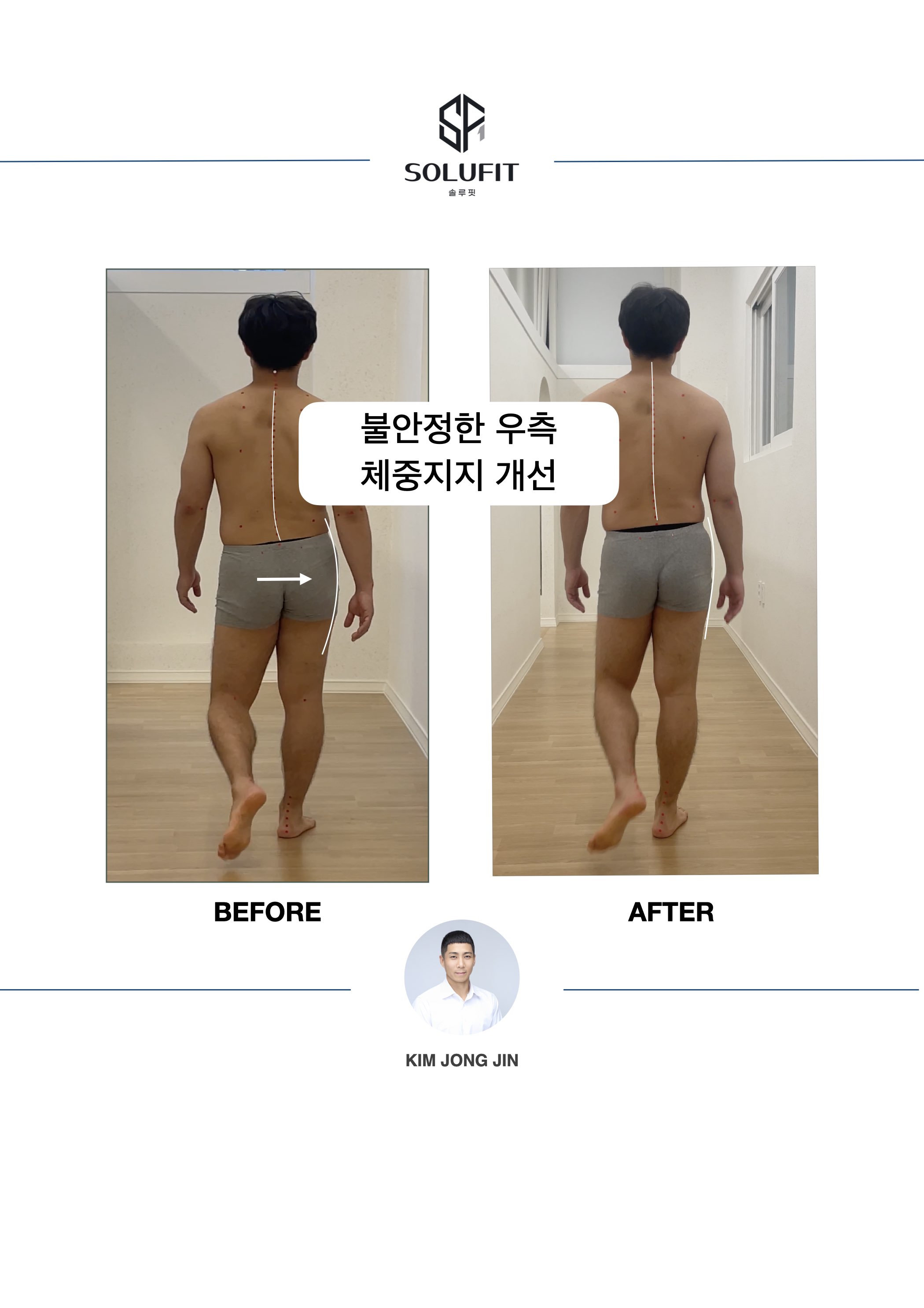 솔루핏 체형교정 & 기능재활