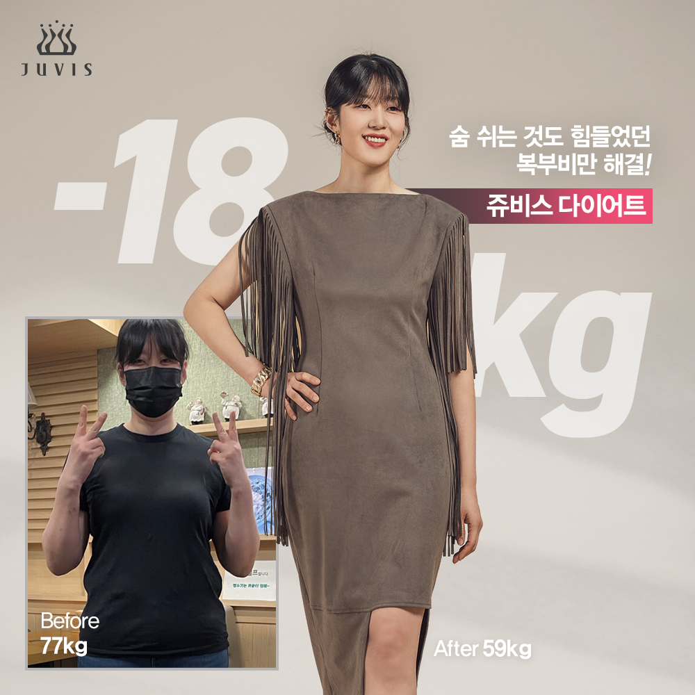 쥬비스 노원점 대표 이미지