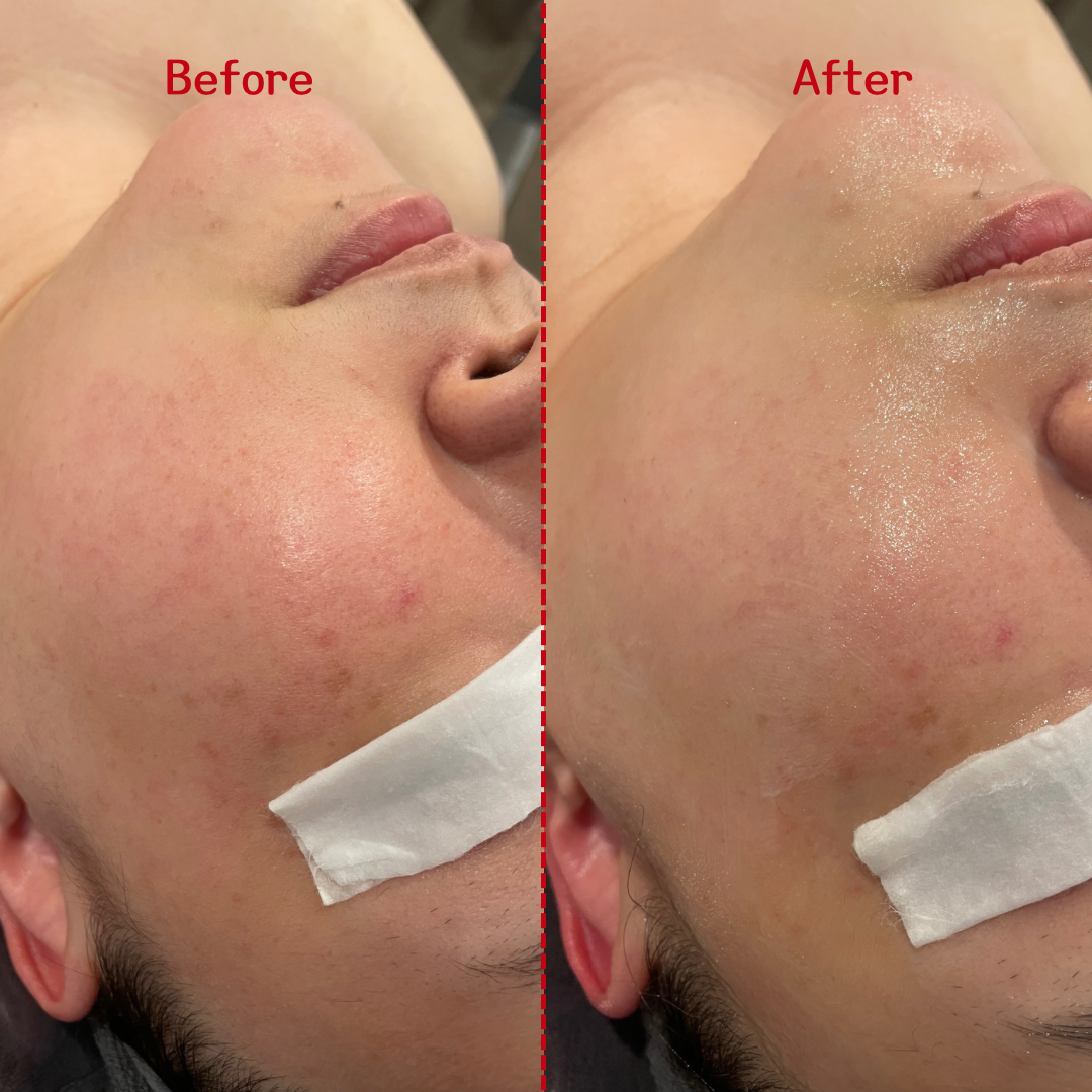 꽃피우는여자 대표 이미지