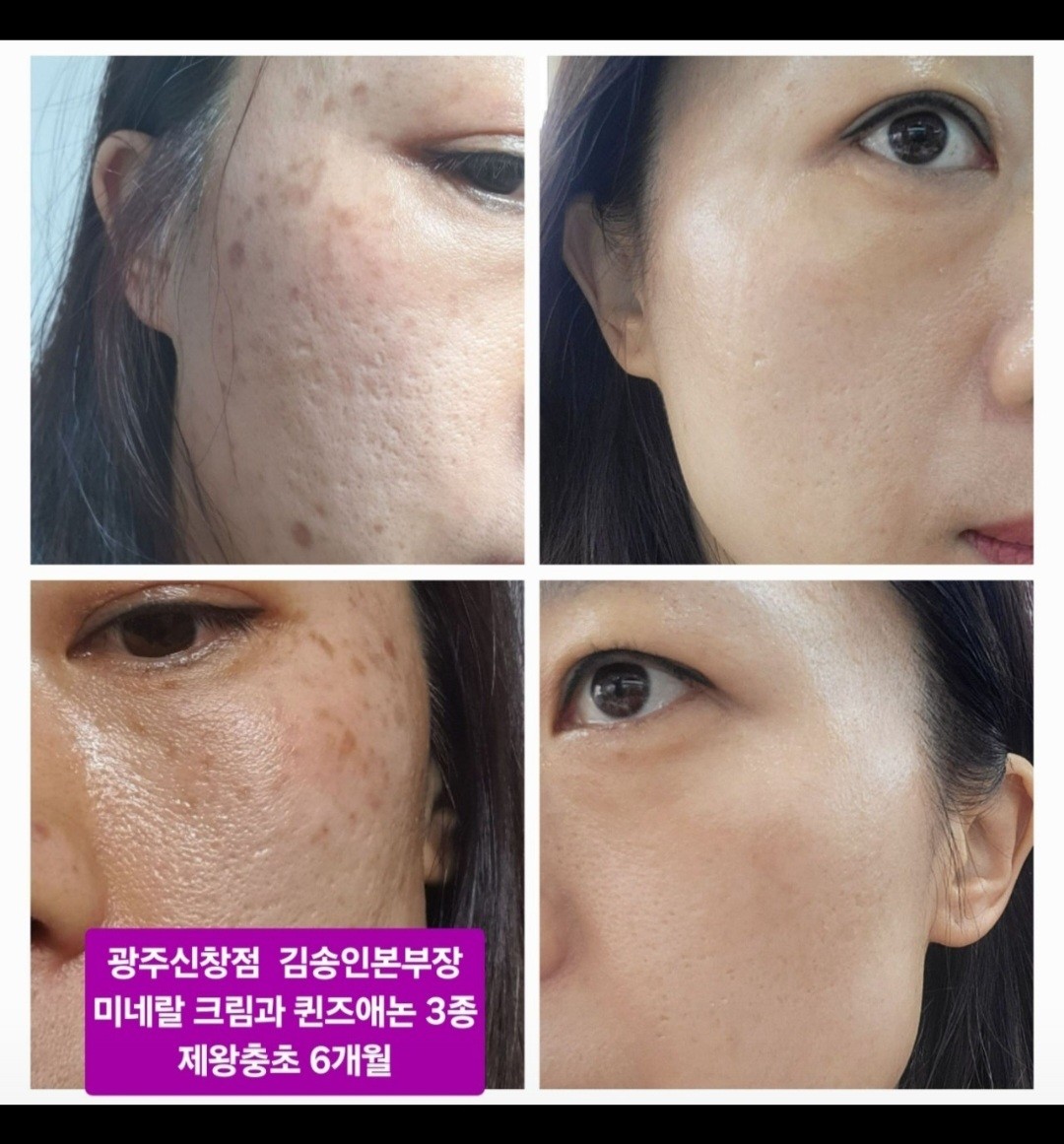 큐사랑 수지신봉점