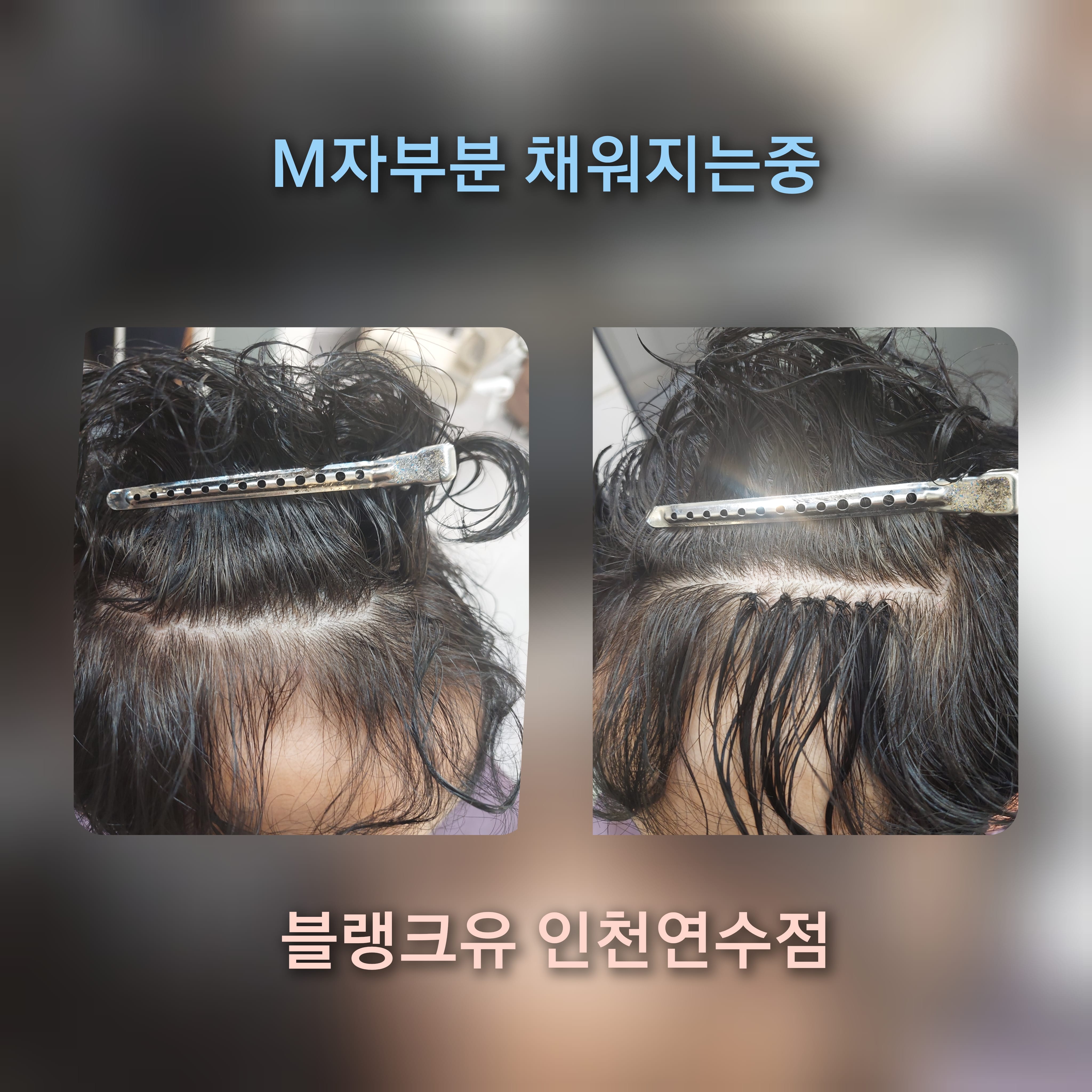 블랭크유 인천연수점