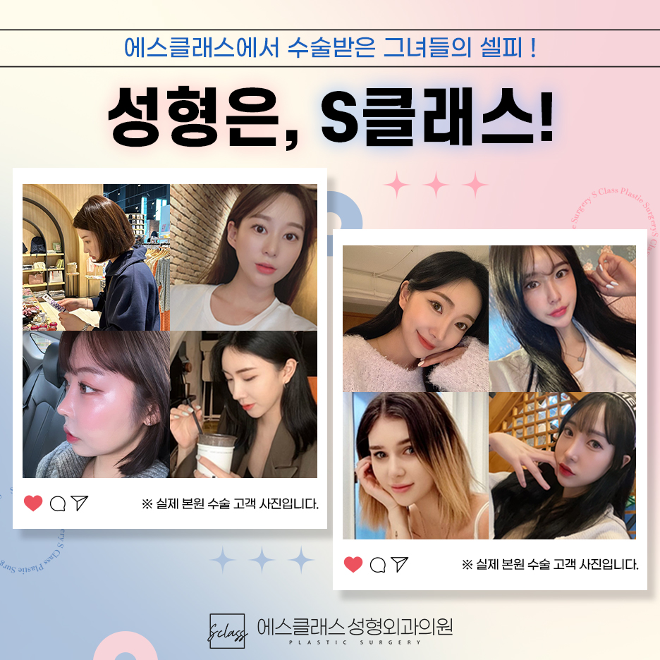 에스클래스성형외과의원