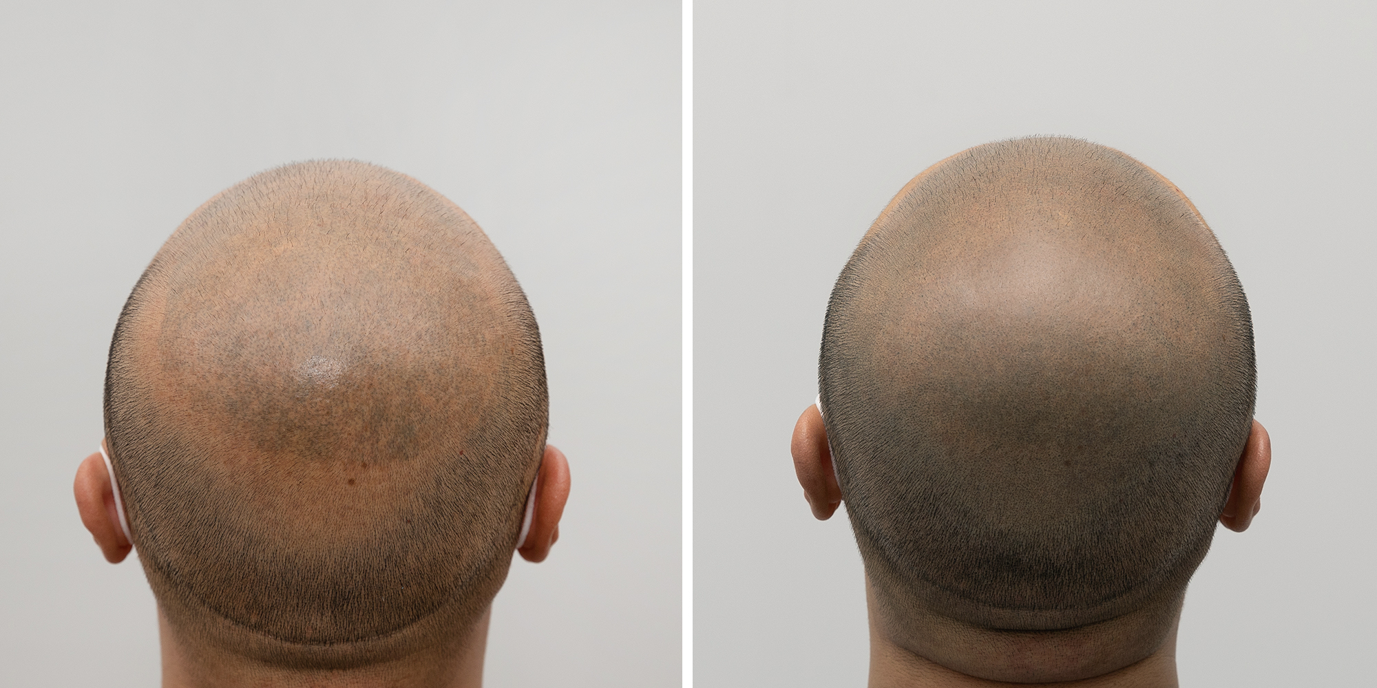 모블리스 본점 대표 이미지