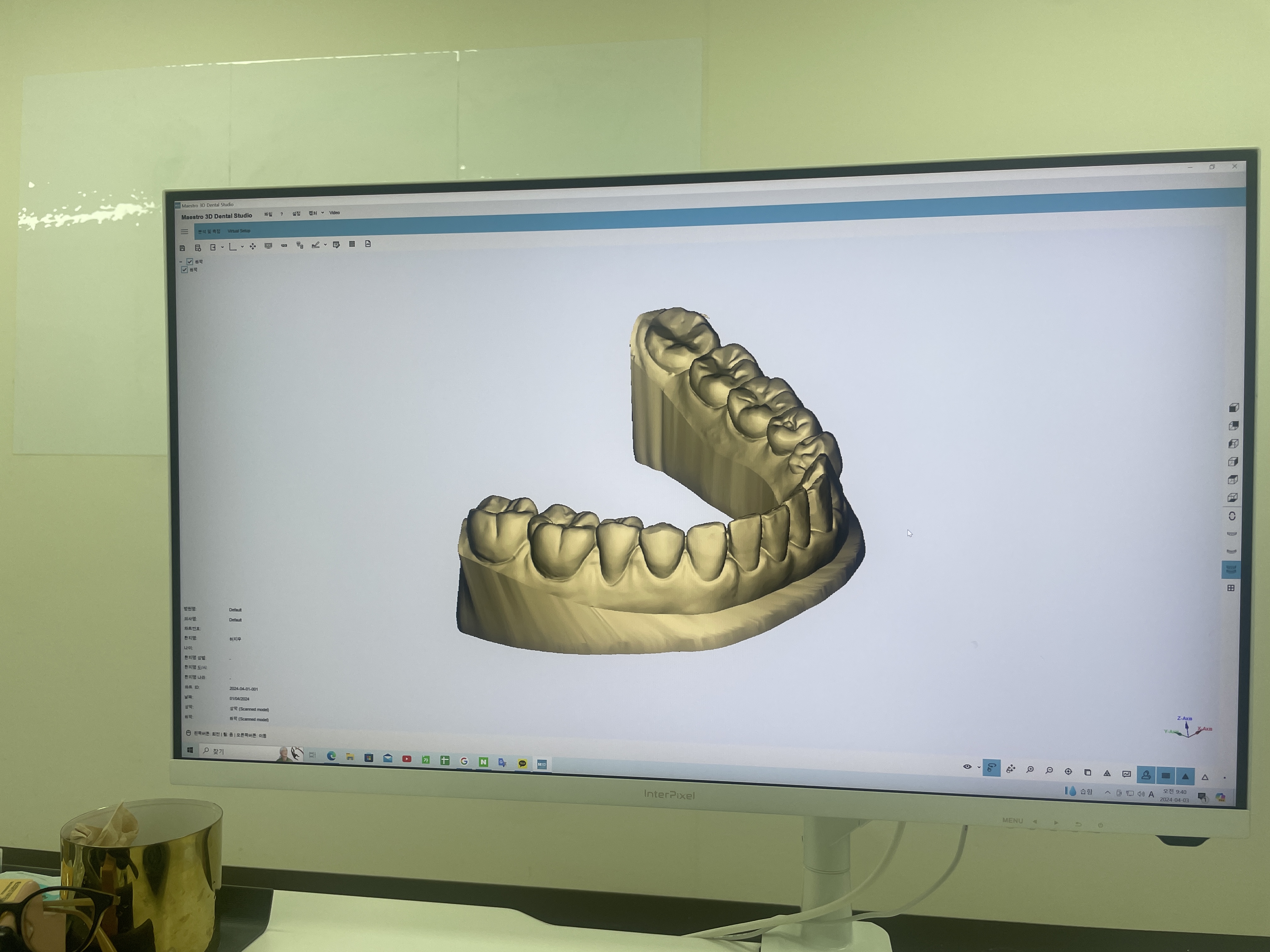 베스트얼라인치과기공소 대표 이미지