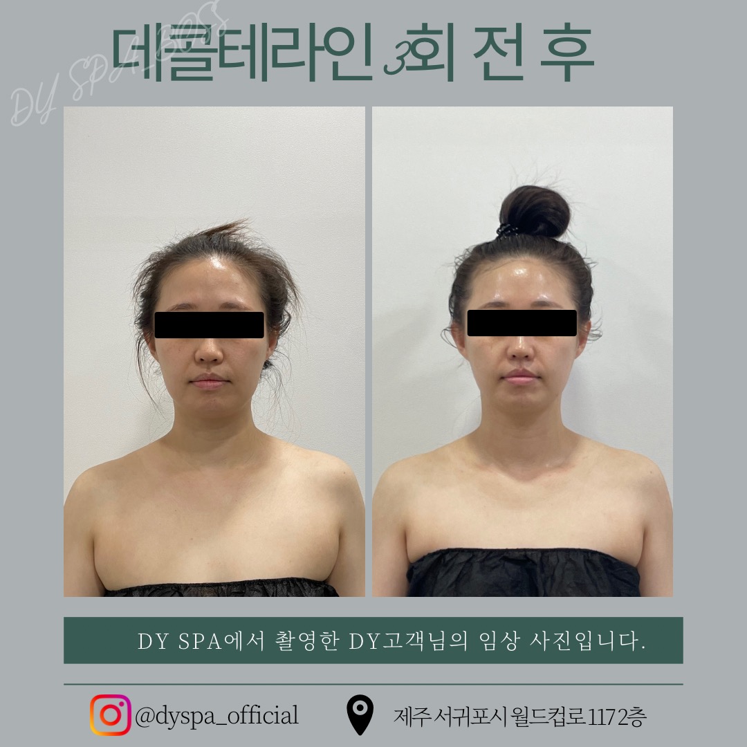 디와이스파 대표 이미지