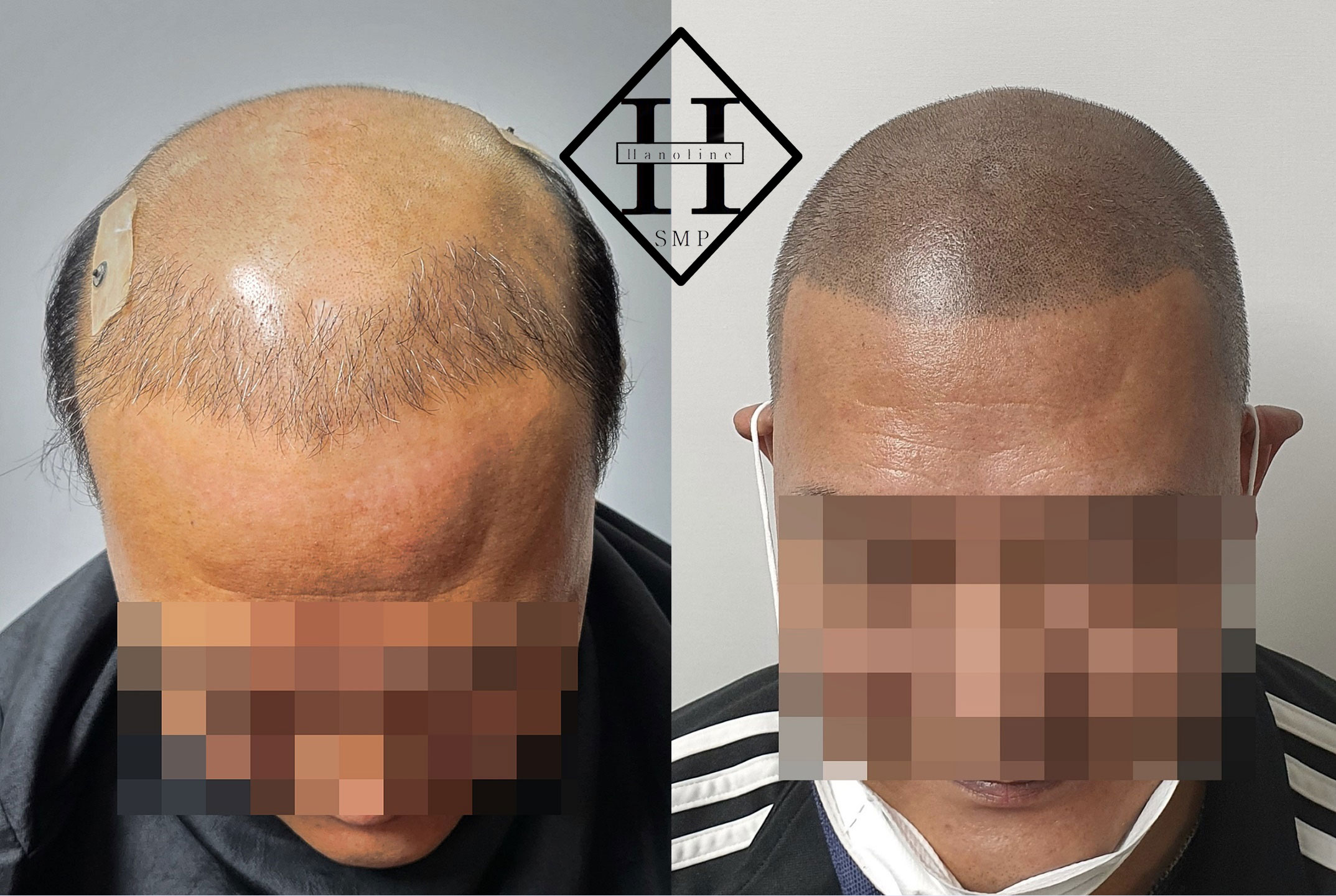 한올SMP 일산 주엽점