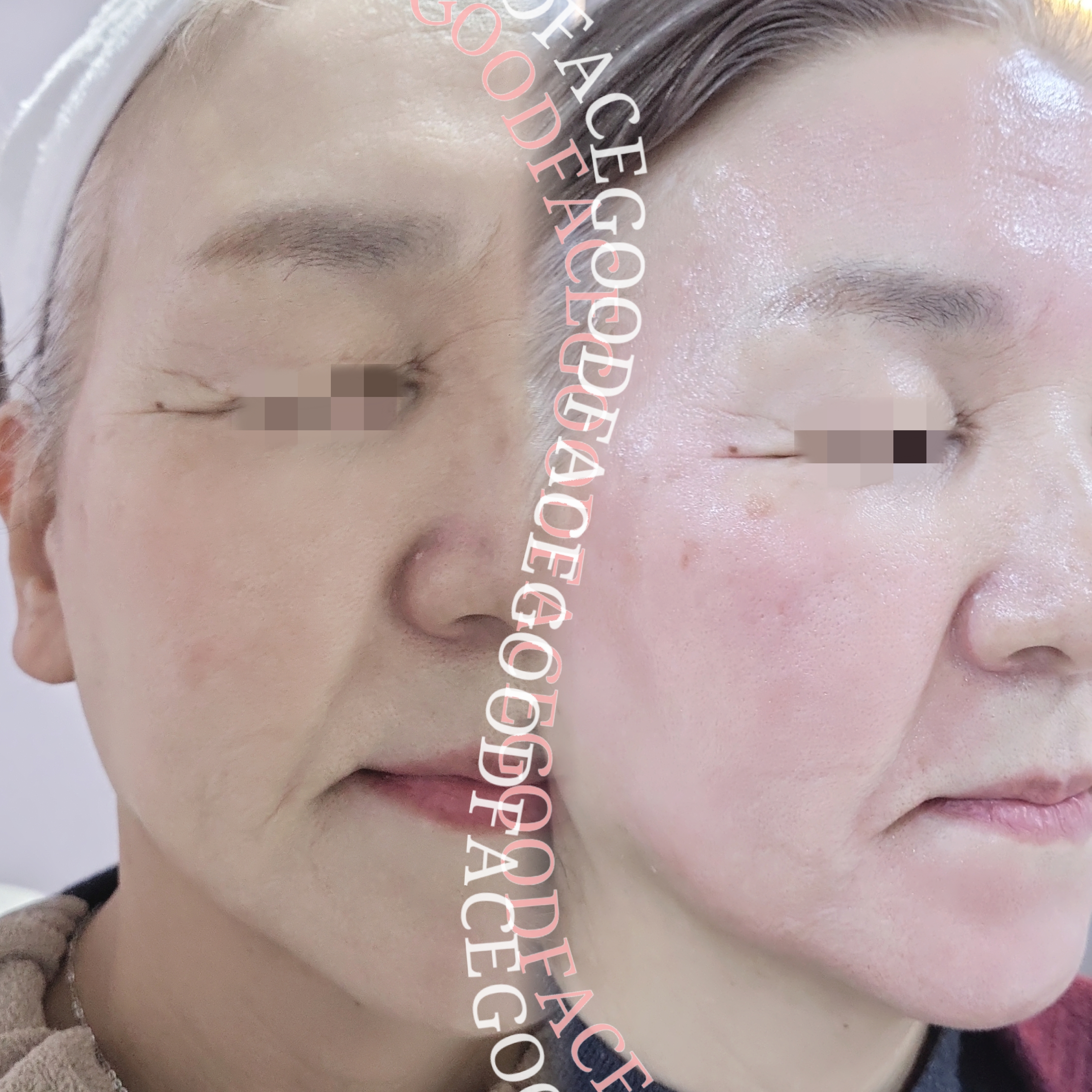 GOODFACE 대표 이미지