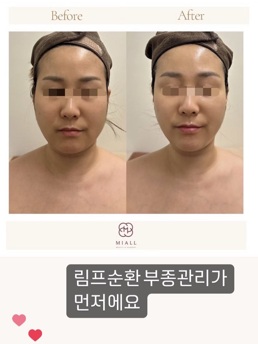 미올뷰티&피부관리&속눈썹펌 다산본점