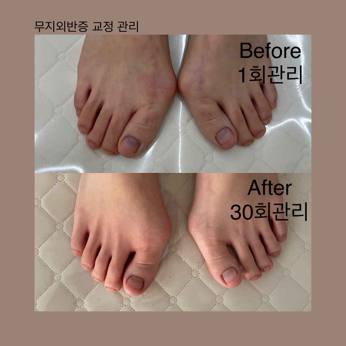 웰니스온도청담 photo 5