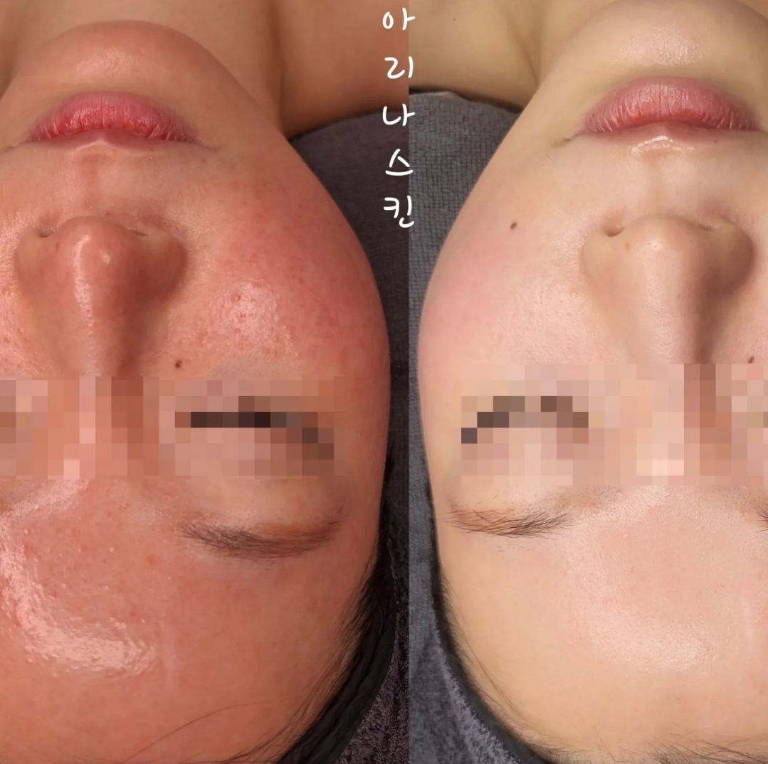 검단피부관리 아리나뷰티 photo 2