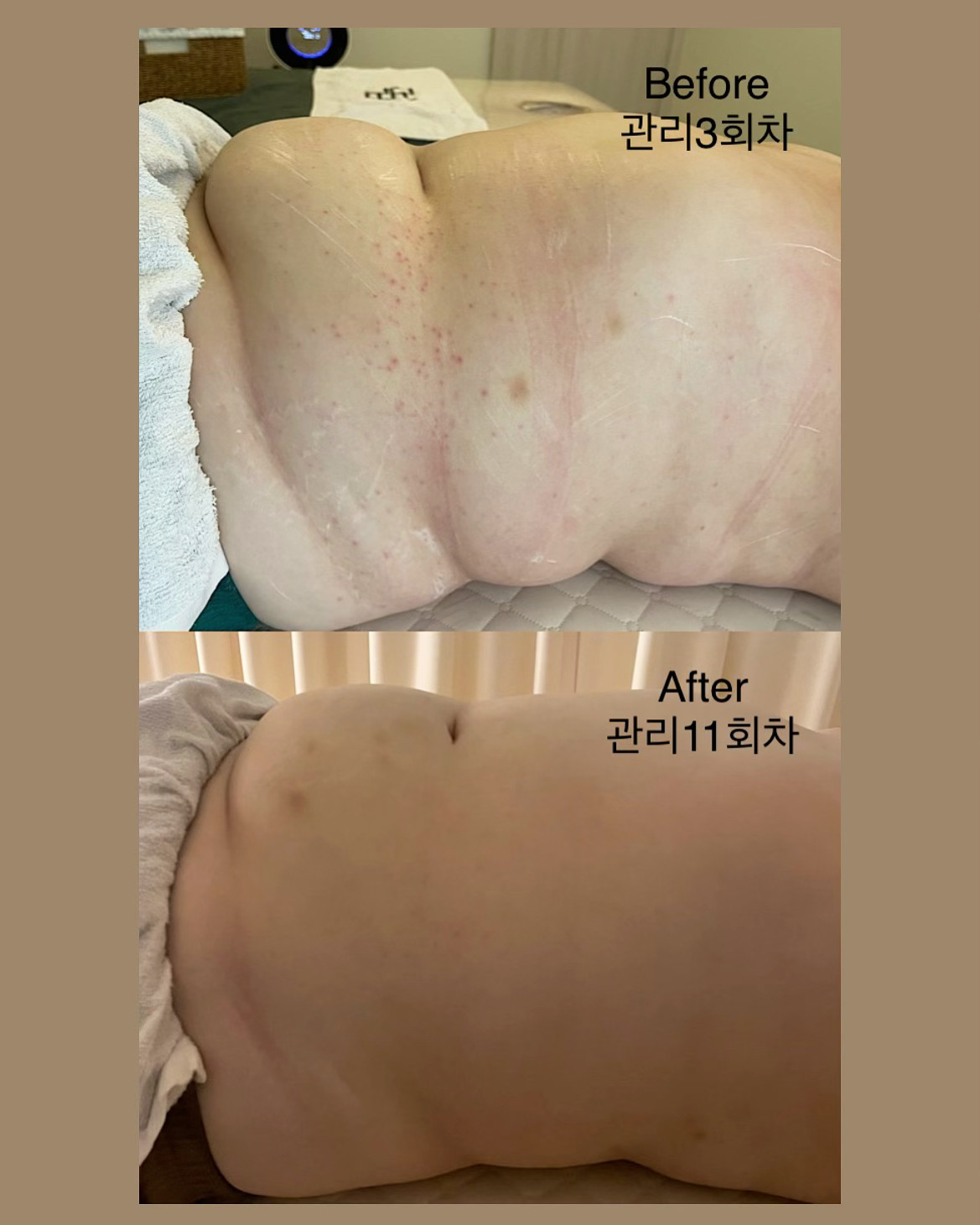 웰니스온도청담 photo 3