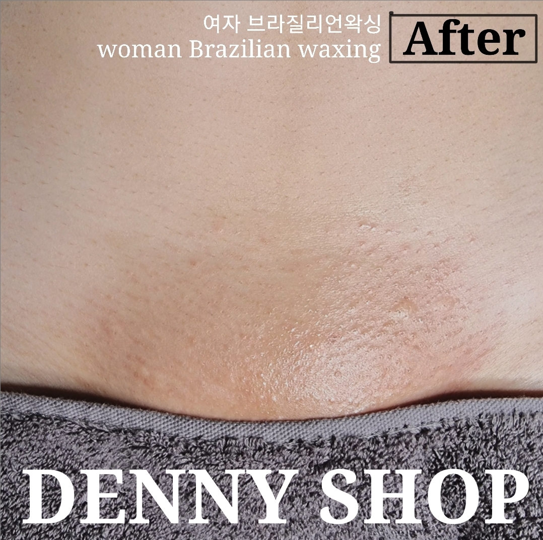 대구 에스테틱&왁싱전문 데니샵 대표 이미지