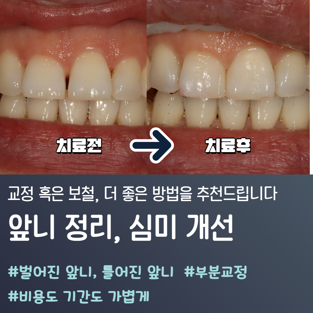 이바른치과교정과치과의원 울산북구송정점 대표 이미지