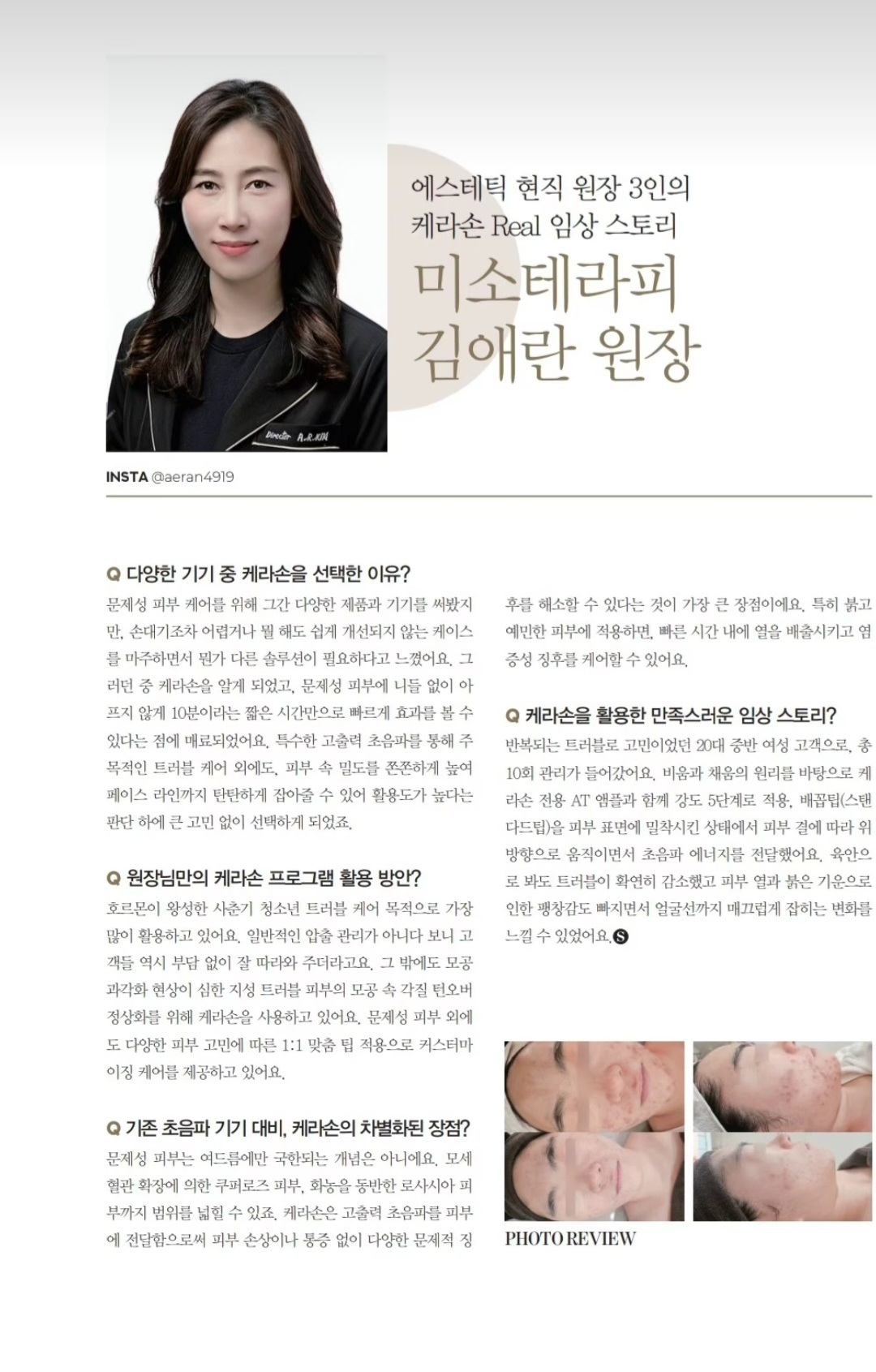 미소에스테틱