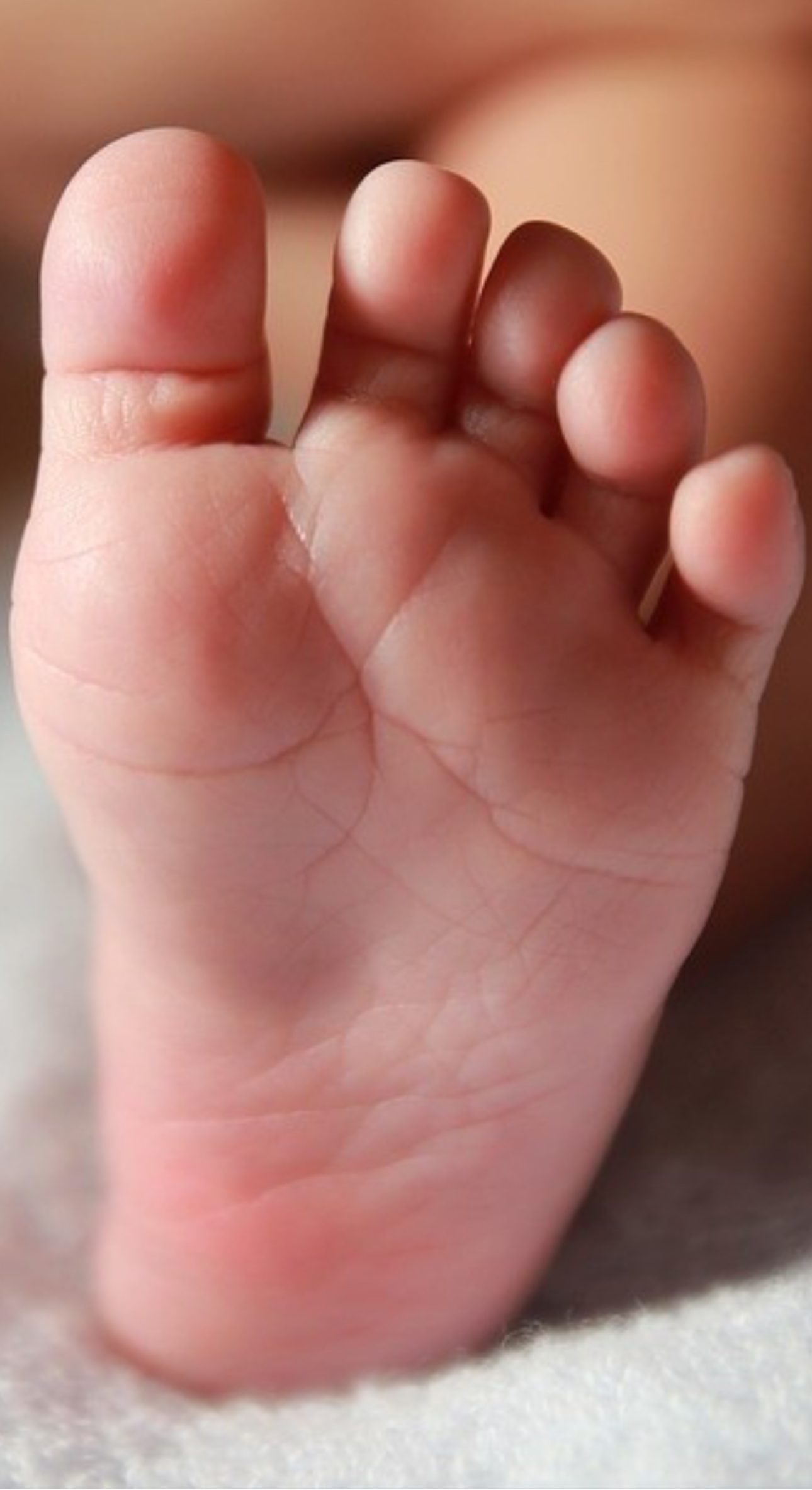 골드문네일 대표 이미지