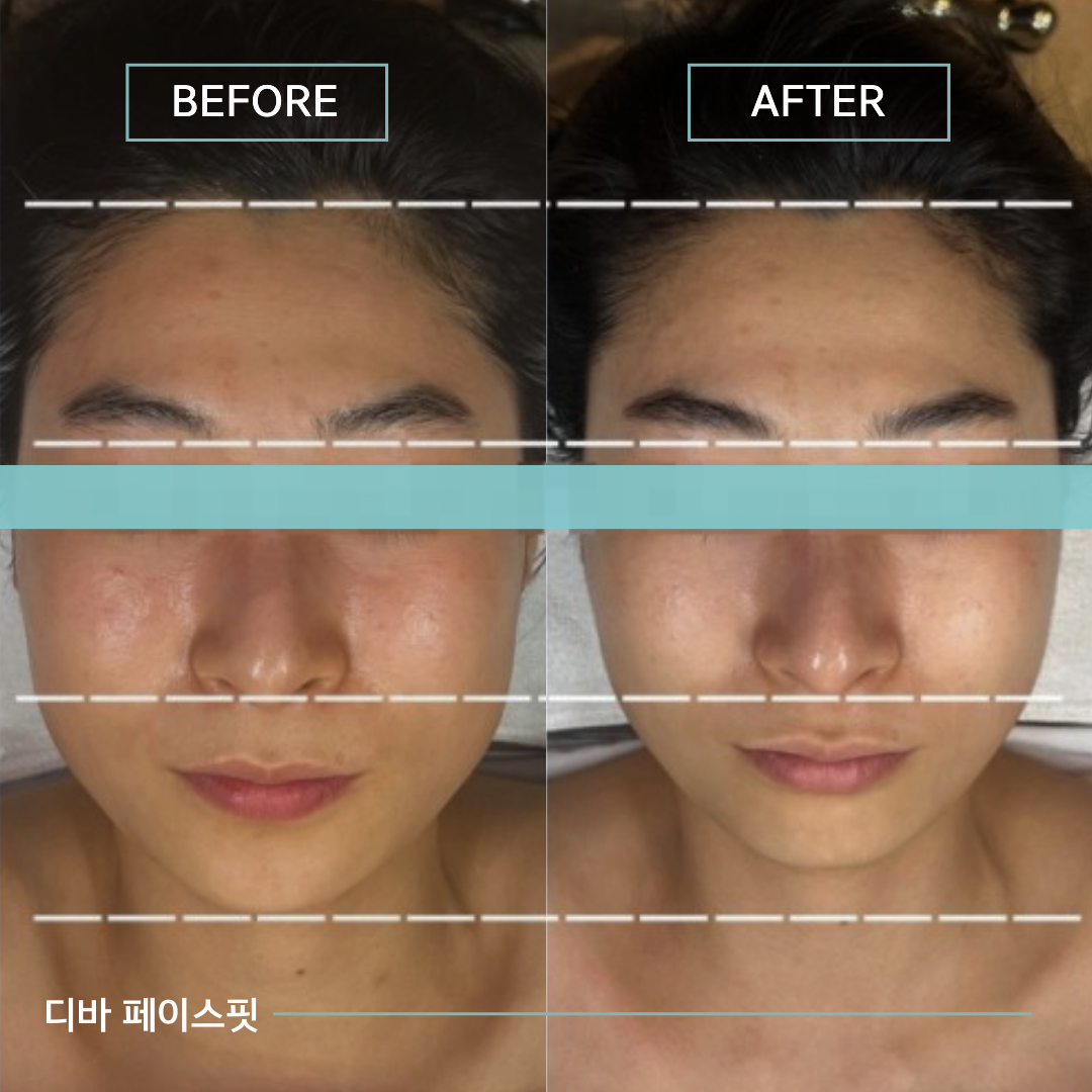 디바스킨 대표 이미지