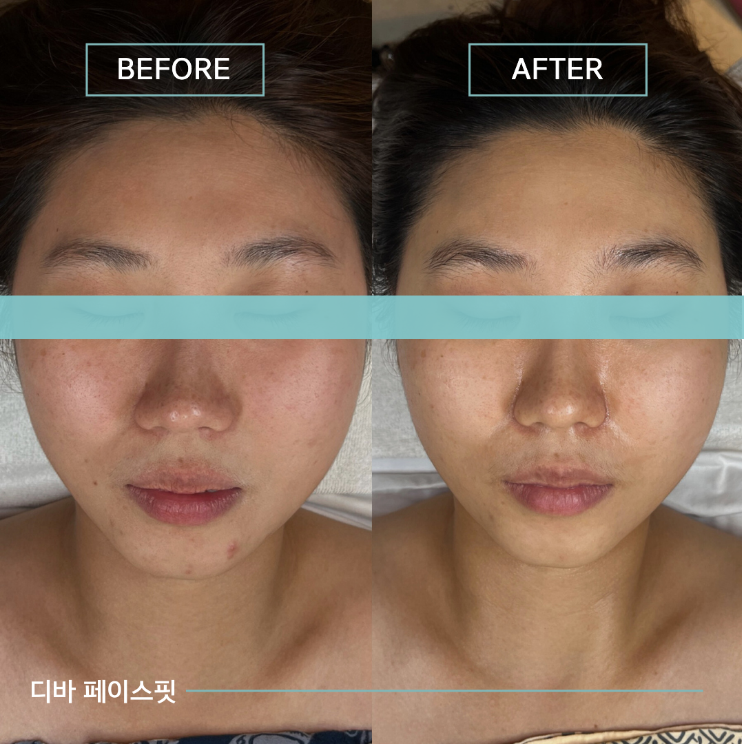 디바스킨 본점 대표 이미지