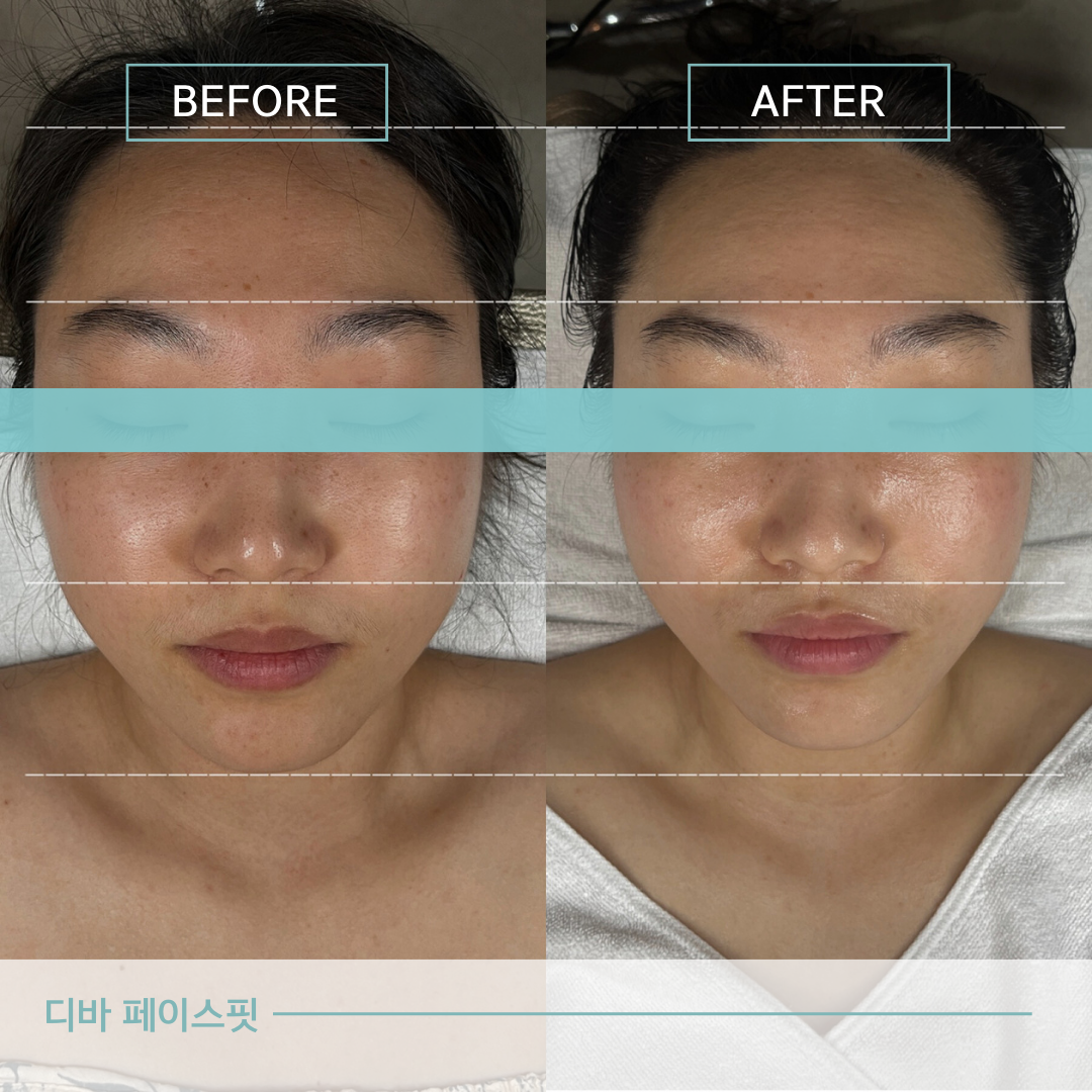 디바스킨 본점 대표 이미지