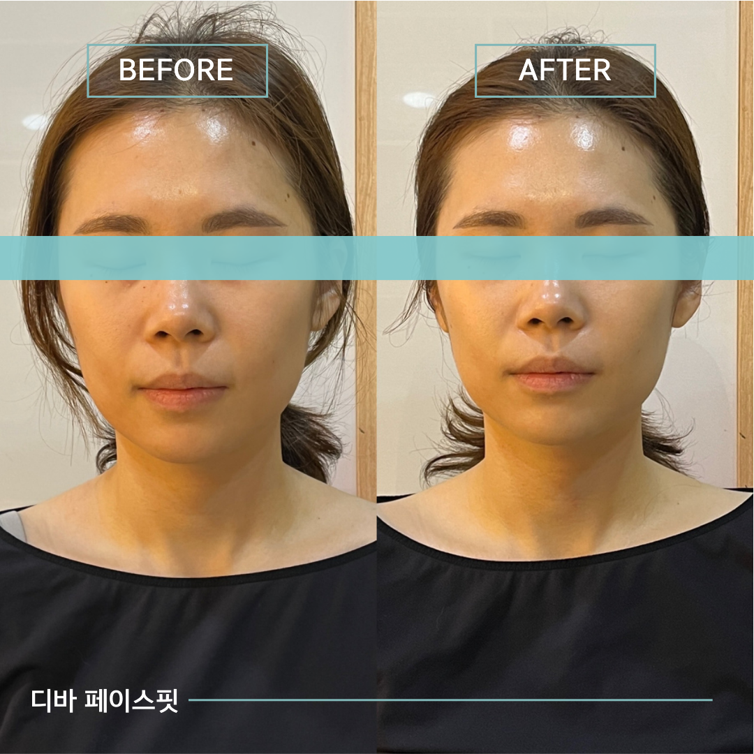 디바스킨 본점 대표 이미지