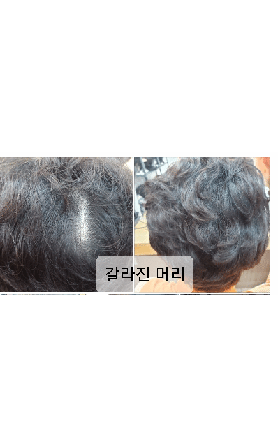 김호증모가발by 진헤어