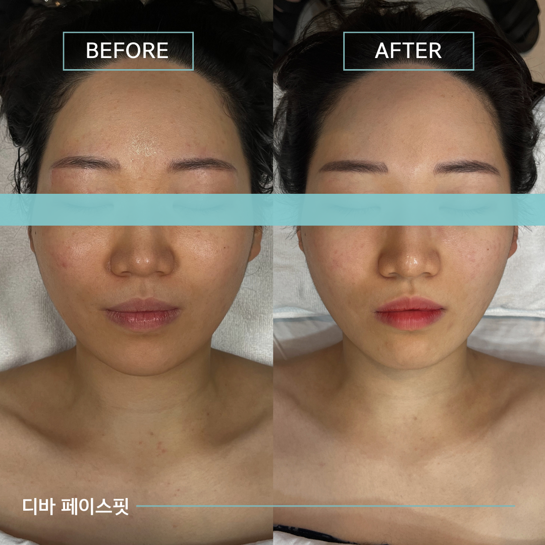 디바스킨 대표 이미지